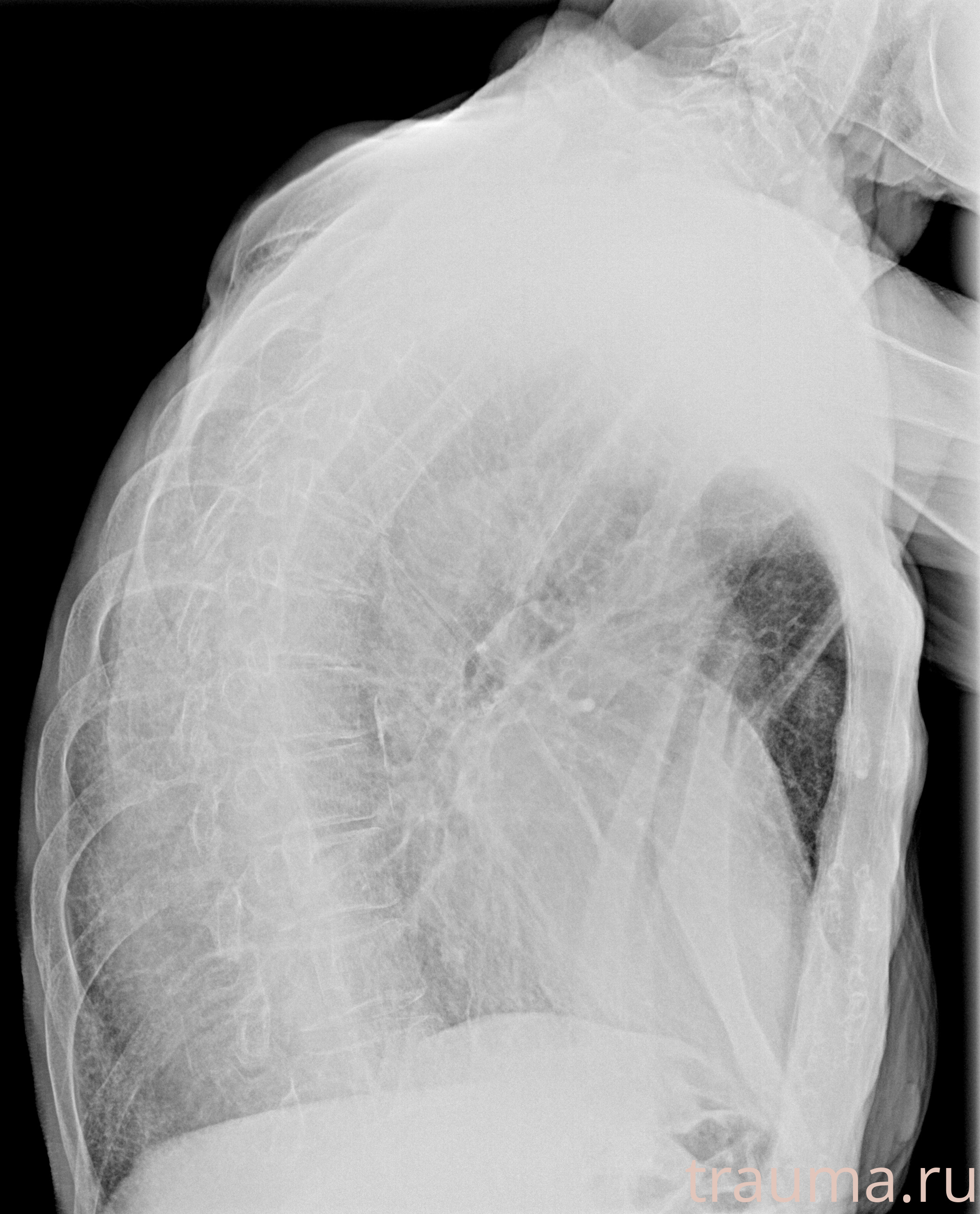 Рентген на дому: по вашему адресу приезжает врач-рентгенолог, травматолог-ортопед с мобильным рентгеновским аппаратом, проводит диагностику травмы или заболевания, делает необходимые рентгенограммы, дает рекомендации по дальнейшему лечению. Получить качественные снимки в домашних условиях возможно благодаря уникальной методике, разработанной МосРентген Центром для института  Склифосовского