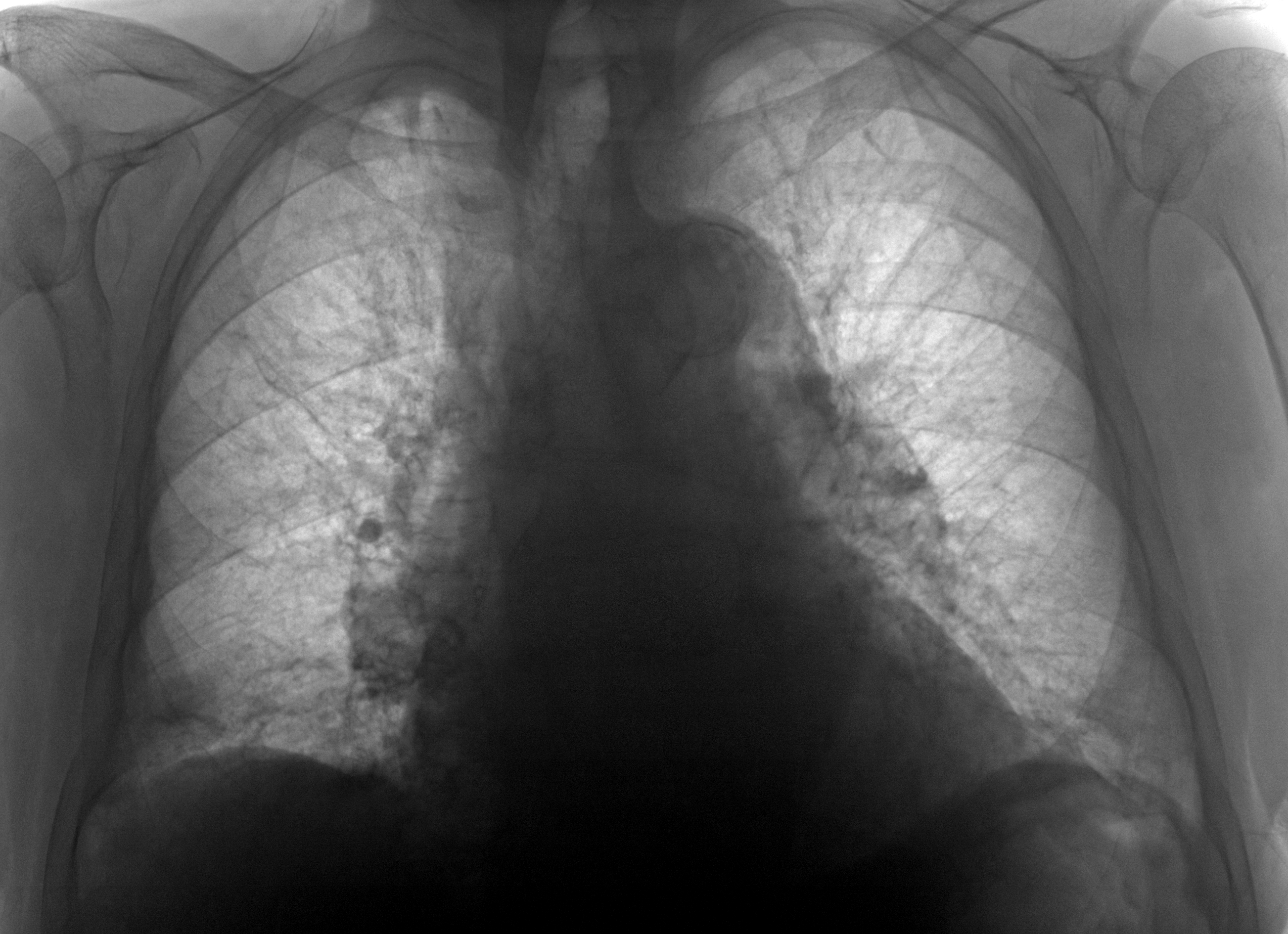 Рентген на дому: по вашему адресу приезжает врач-рентгенолог, травматолог-ортопед с мобильным рентгеновским аппаратом, проводит диагностику травмы или заболевания, делает необходимые рентгенограммы, дает рекомендации по дальнейшему лечению. Получить качественные снимки в домашних условиях возможно благодаря уникальной методике, разработанной МосРентген Центром для института  Склифосовского