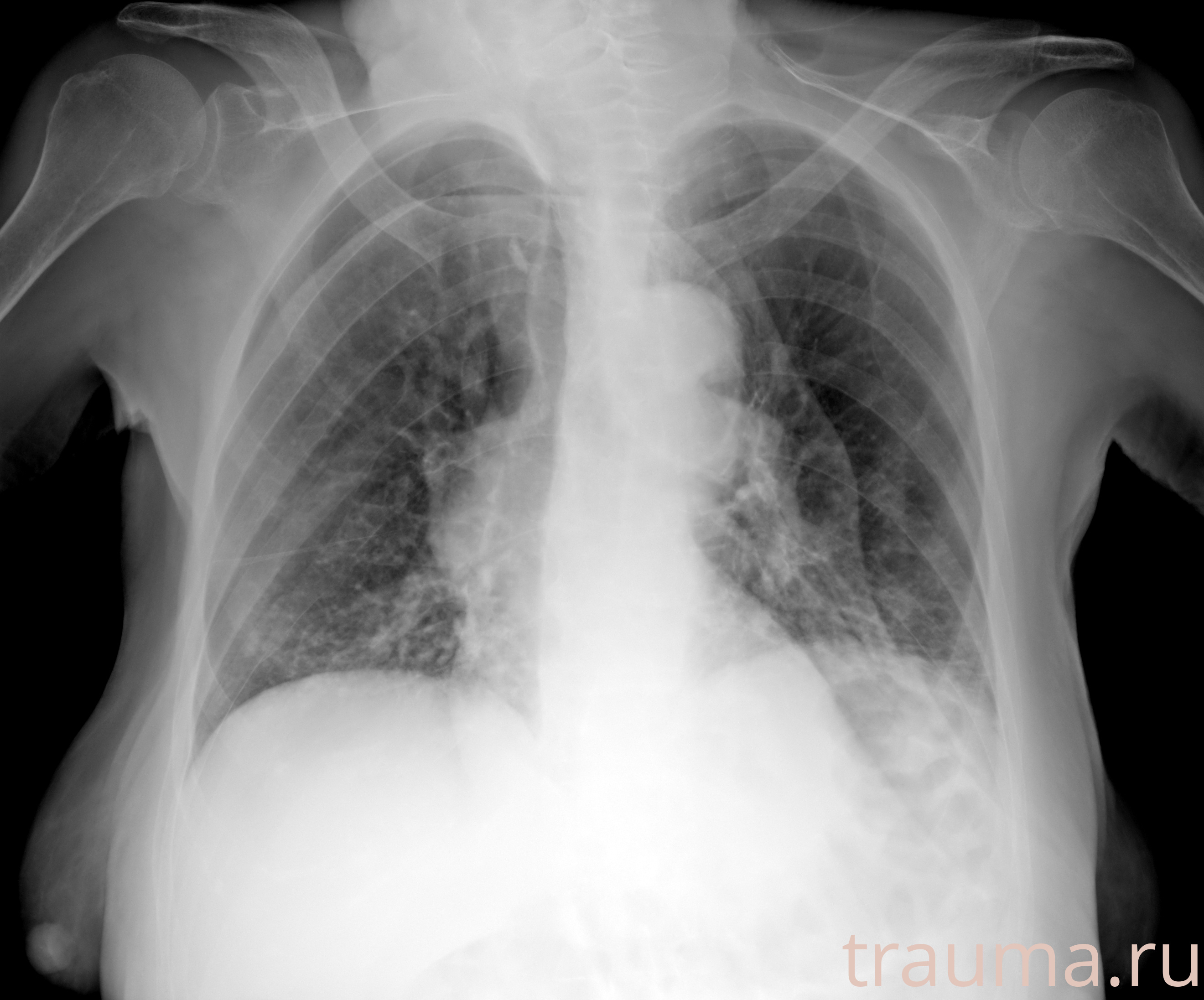 Рентген на дому: по вашему адресу приезжает врач-рентгенолог, травматолог-ортопед с мобильным рентгеновским аппаратом, проводит диагностику травмы или заболевания, делает необходимые рентгенограммы, дает рекомендации по дальнейшему лечению. Получить качественные снимки в домашних условиях возможно благодаря уникальной методике, разработанной МосРентген Центром для института  Склифосовского