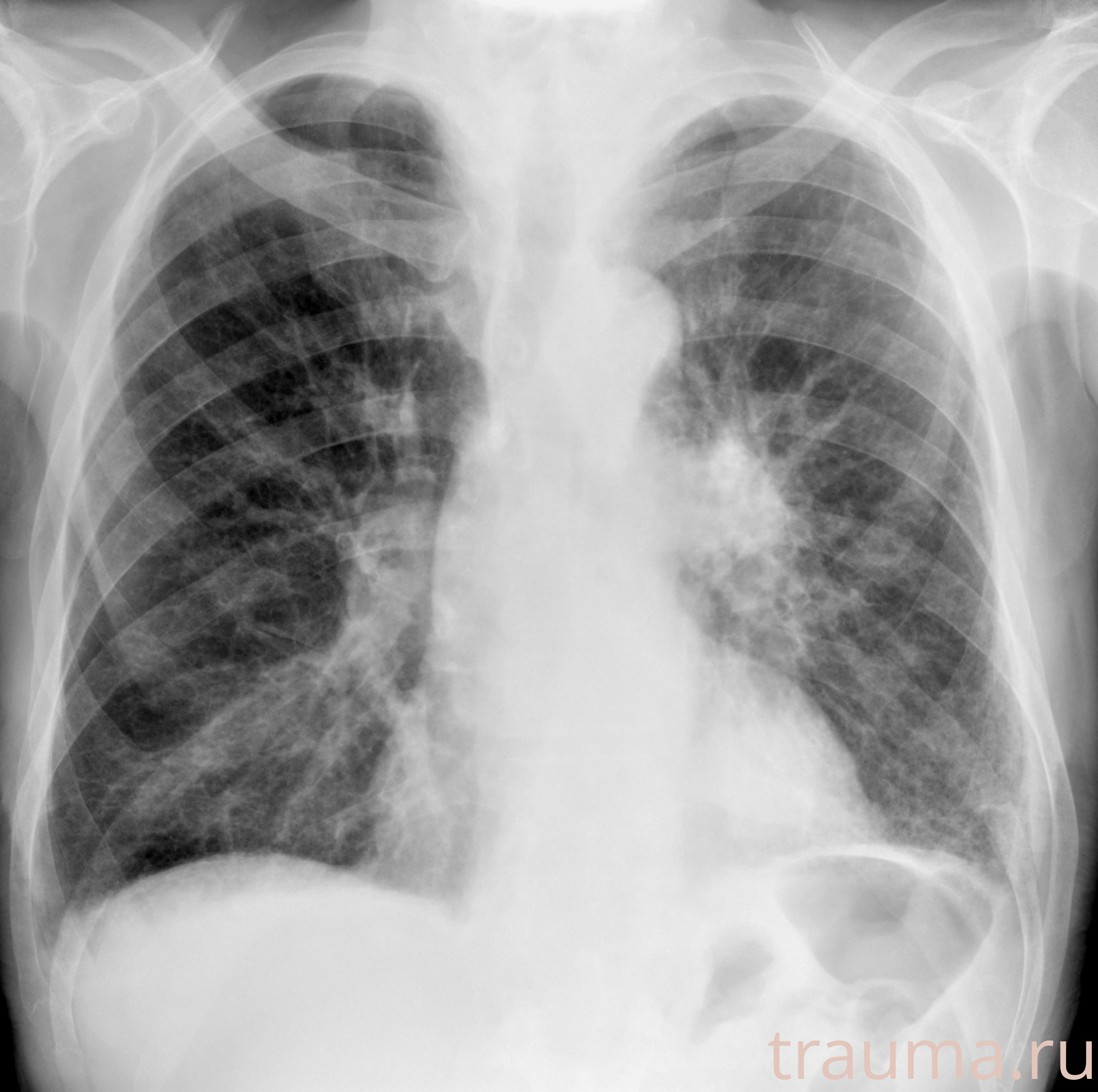 Рентген на дому: по вашему адресу приезжает врач-рентгенолог, травматолог-ортопед с мобильным рентгеновским аппаратом, проводит диагностику травмы или заболевания, делает необходимые рентгенограммы, дает рекомендации по дальнейшему лечению. Получить качественные снимки в домашних условиях возможно благодаря уникальной методике, разработанной МосРентген Центром для института  Склифосовского