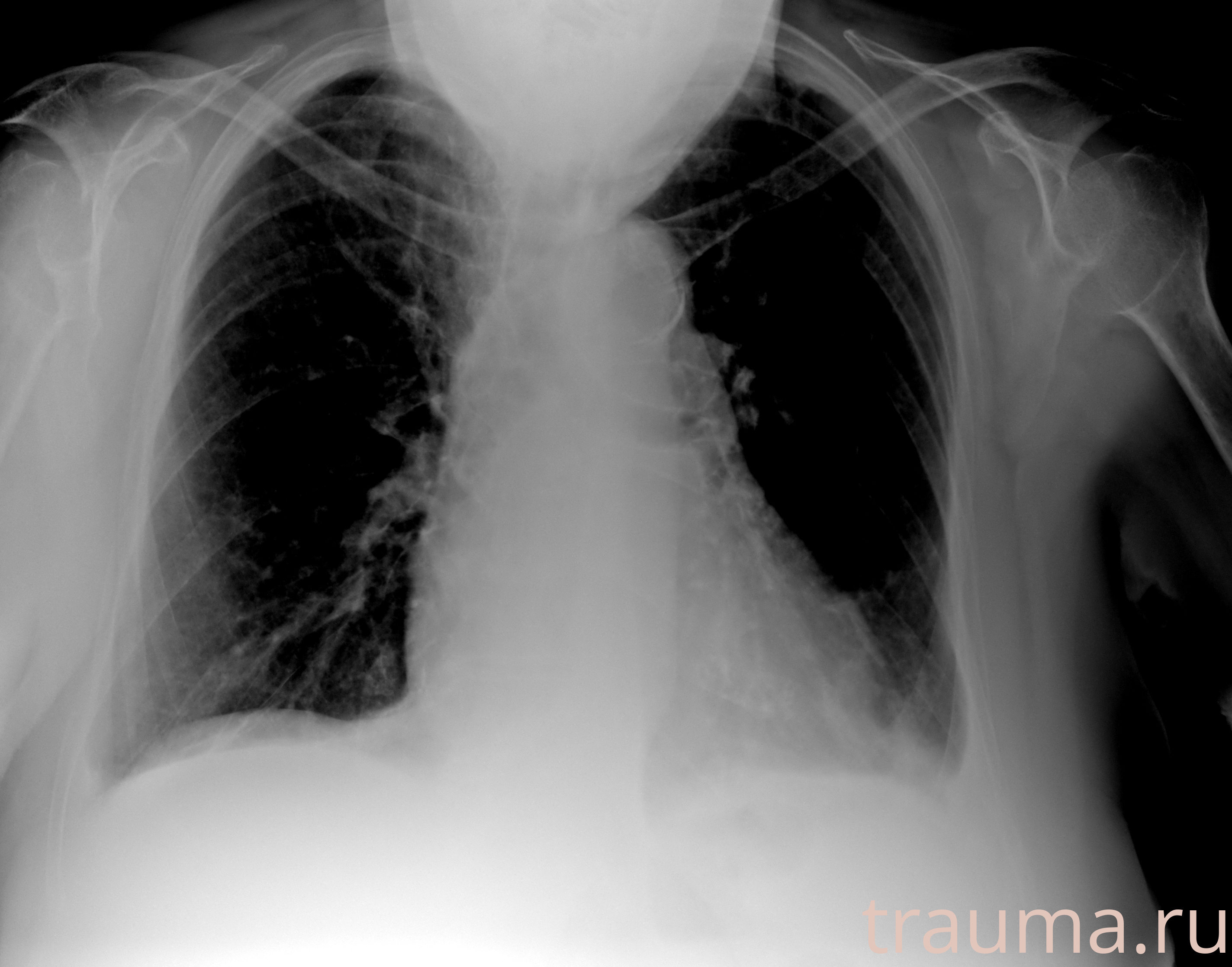 Рентген на дому: по вашему адресу приезжает врач-рентгенолог, травматолог-ортопед с мобильным рентгеновским аппаратом, проводит диагностику травмы или заболевания, делает необходимые рентгенограммы, дает рекомендации по дальнейшему лечению. Получить качественные снимки в домашних условиях возможно благодаря уникальной методике, разработанной МосРентген Центром для института  Склифосовского