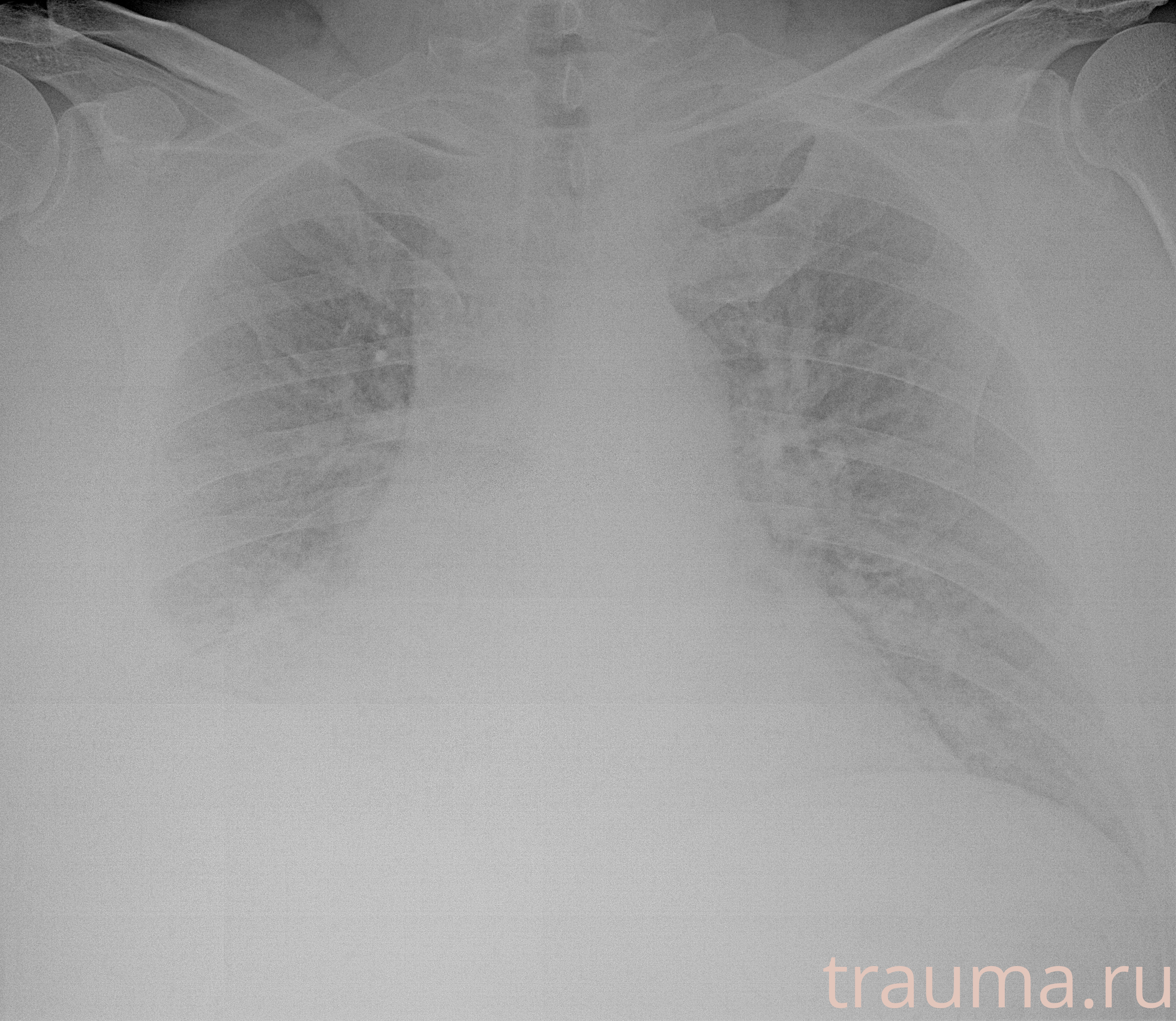 Рентген на дому: по вашему адресу приезжает врач-рентгенолог, травматолог-ортопед с мобильным рентгеновским аппаратом, проводит диагностику травмы или заболевания, делает необходимые рентгенограммы, дает рекомендации по дальнейшему лечению. Получить качественные снимки в домашних условиях возможно благодаря уникальной методике, разработанной МосРентген Центром для института  Склифосовского