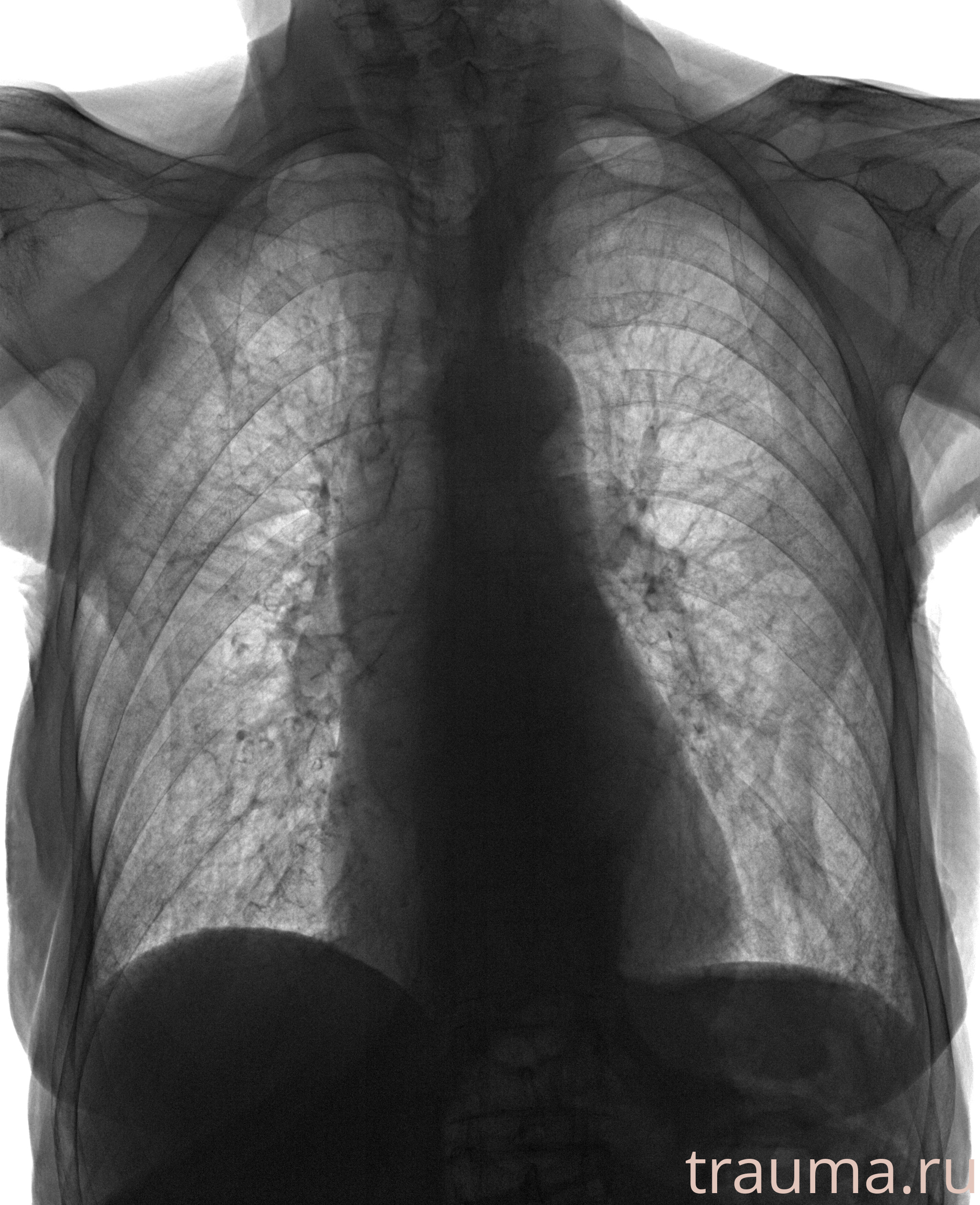 Рентген на дому: по вашему адресу приезжает врач-рентгенолог, травматолог-ортопед с мобильным рентгеновским аппаратом, проводит диагностику травмы или заболевания, делает необходимые рентгенограммы, дает рекомендации по дальнейшему лечению. Получить качественные снимки в домашних условиях возможно благодаря уникальной методике, разработанной МосРентген Центром для института  Склифосовского