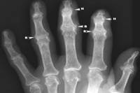 TQT — испытание кассет в программе для цифровой рентгенографии Image Suite TQT — испытание кассет в программе для цифровой рентгенографии Image Suite