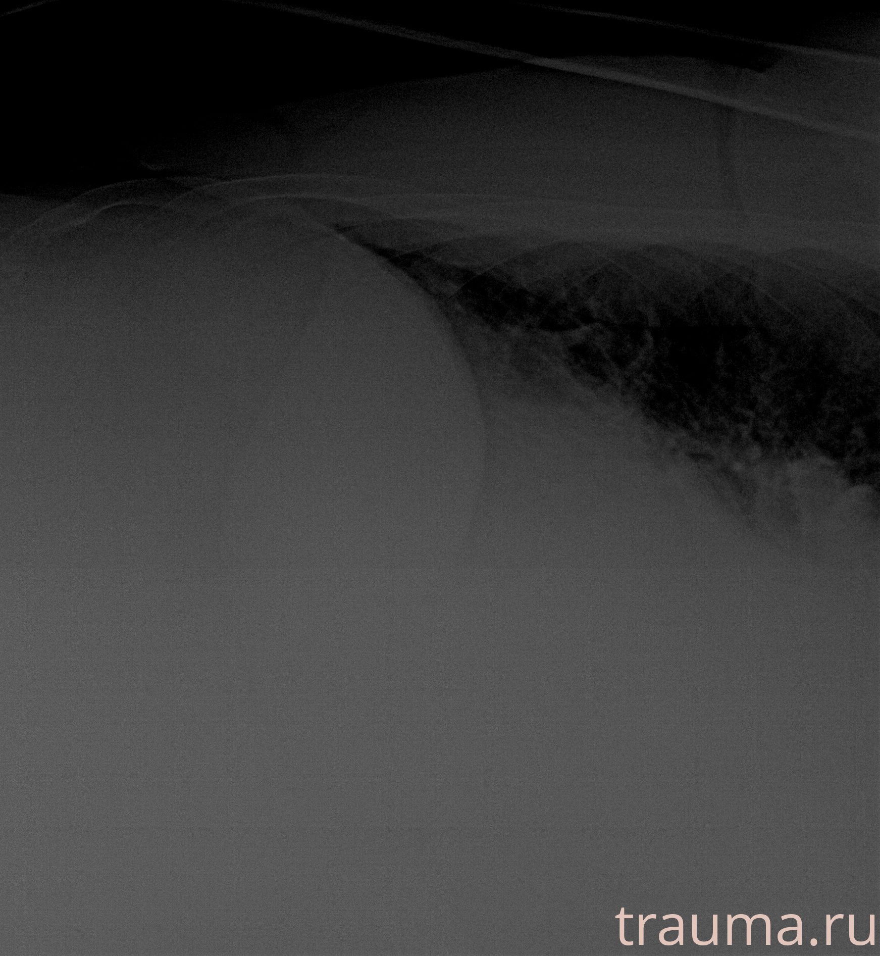 Рентген на дому: по вашему адресу приезжает врач-рентгенолог, травматолог-ортопед с мобильным рентгеновским аппаратом, проводит диагностику травмы или заболевания, делает необходимые рентгенограммы, дает рекомендации по дальнейшему лечению. Получить качественные снимки в домашних условиях возможно благодаря уникальной методике, разработанной МосРентген Центром для института  Склифосовского