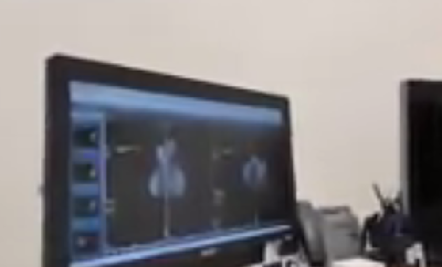 Пациенты столичных поликлиник теперь могут быстрее пройти рентген