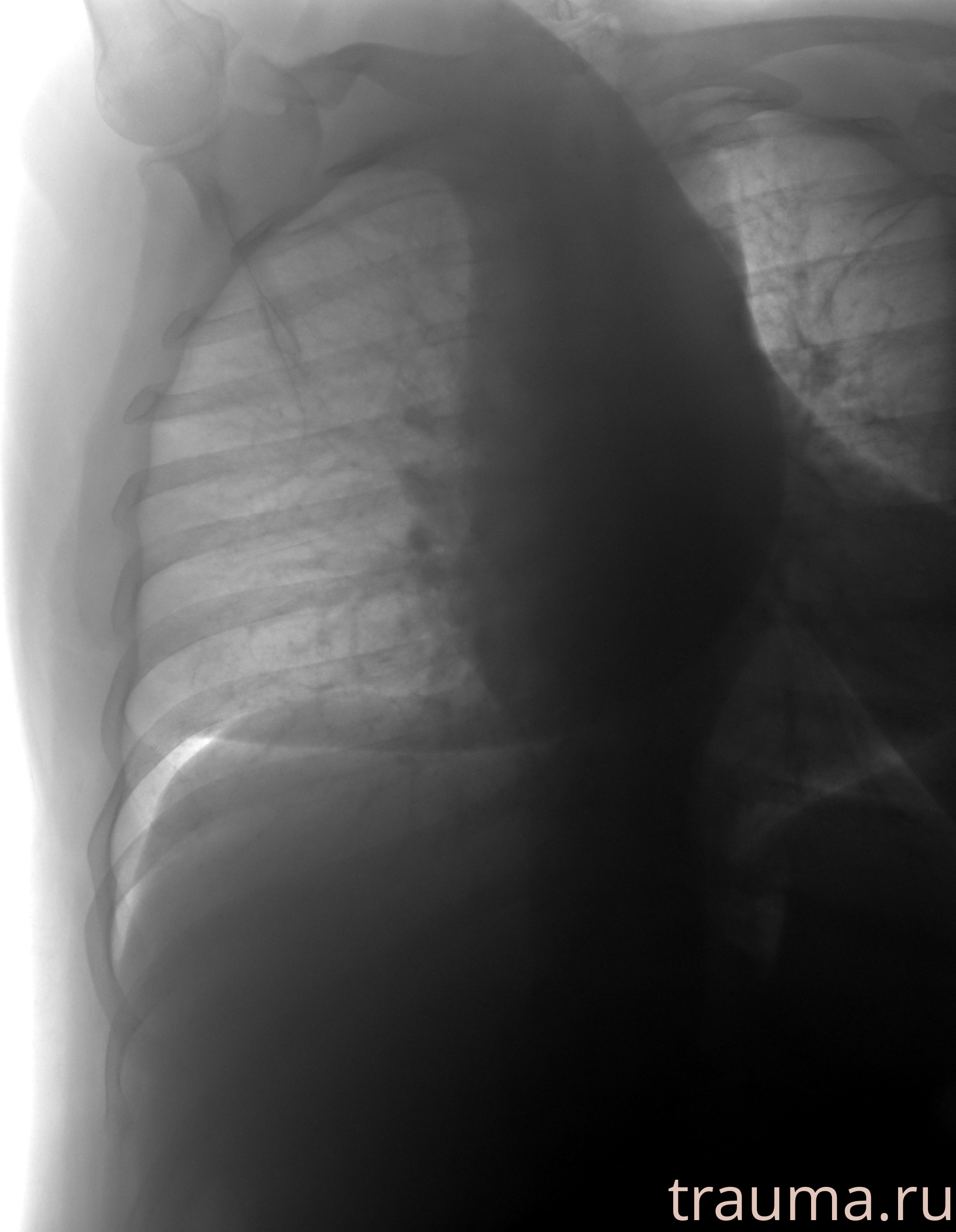 Рентген на дому: по вашему адресу приезжает врач-рентгенолог, травматолог-ортопед с мобильным рентгеновским аппаратом, проводит диагностику травмы или заболевания, делает необходимые рентгенограммы, дает рекомендации по дальнейшему лечению. Получить качественные снимки в домашних условиях возможно благодаря уникальной методике, разработанной МосРентген Центром для института  Склифосовского