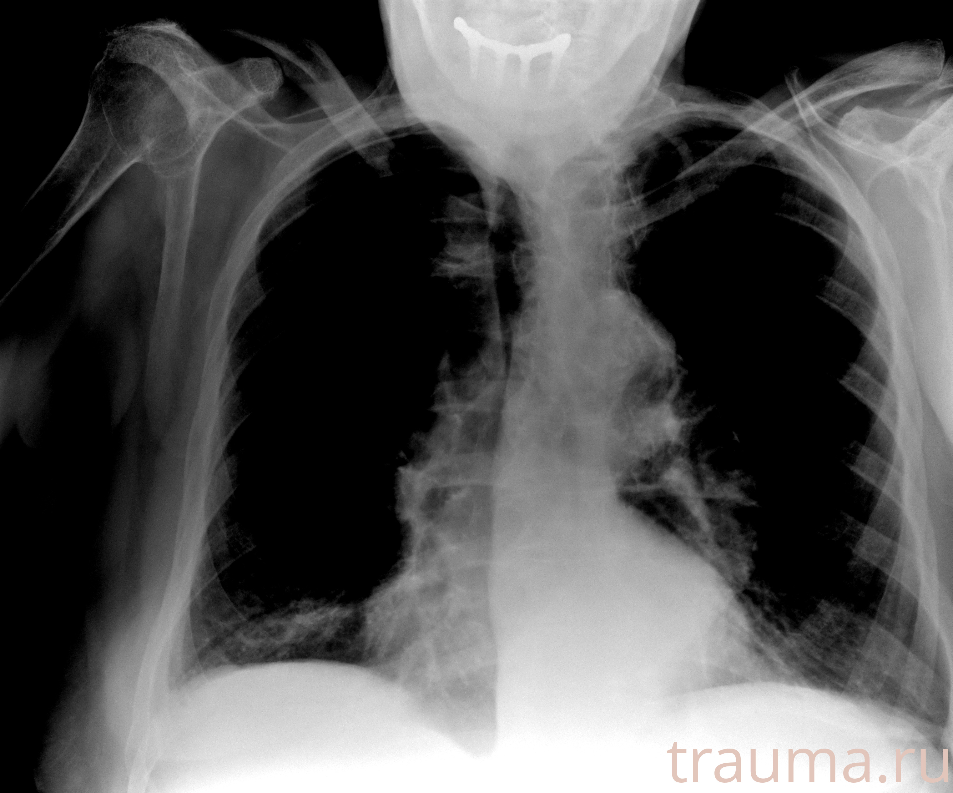 Рентген на дому: по вашему адресу приезжает врач-рентгенолог, травматолог-ортопед с мобильным рентгеновским аппаратом, проводит диагностику травмы или заболевания, делает необходимые рентгенограммы, дает рекомендации по дальнейшему лечению. Получить качественные снимки в домашних условиях возможно благодаря уникальной методике, разработанной МосРентген Центром для института  Склифосовского