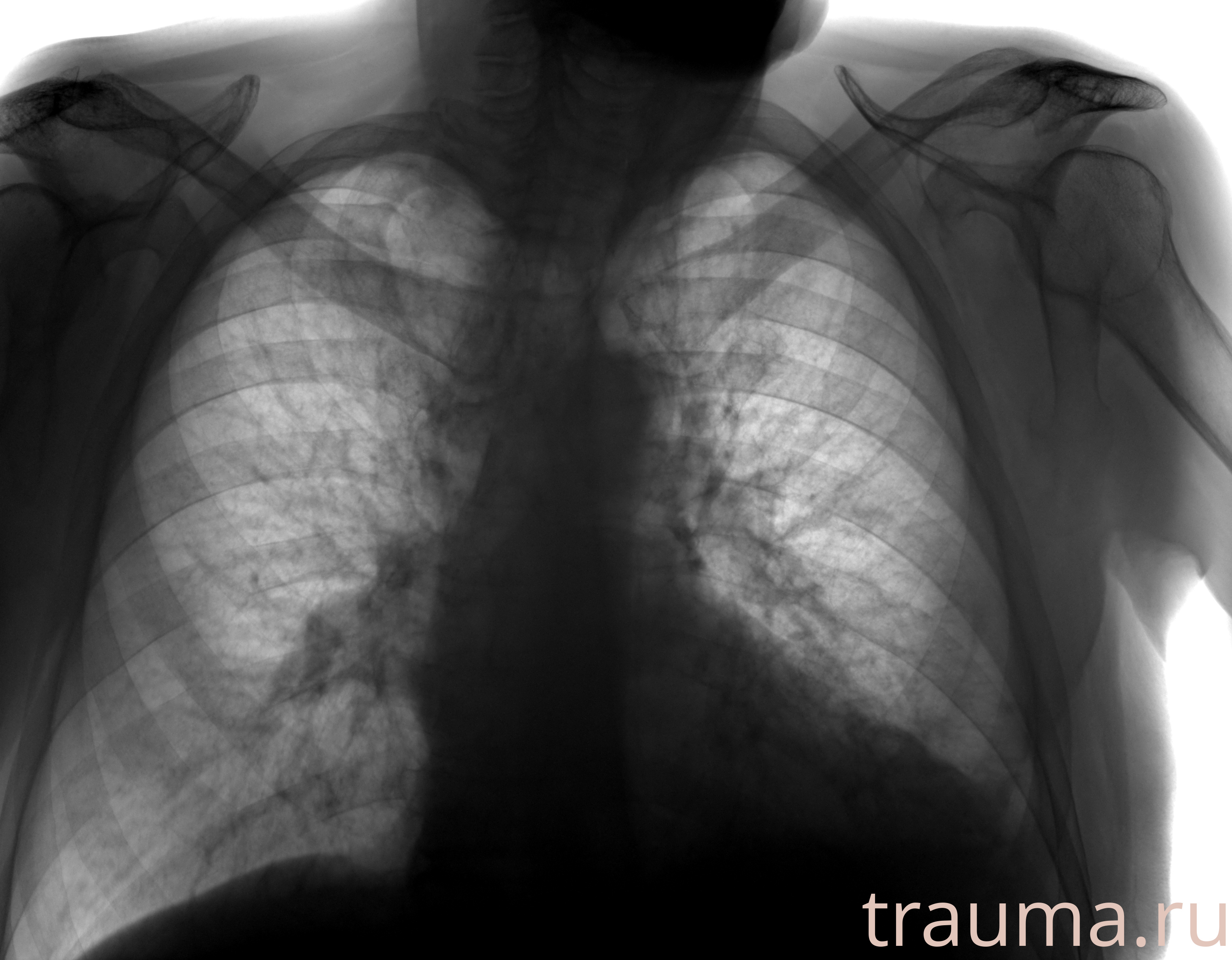 Рентген на дому: по вашему адресу приезжает врач-рентгенолог, травматолог-ортопед с мобильным рентгеновским аппаратом, проводит диагностику травмы или заболевания, делает необходимые рентгенограммы, дает рекомендации по дальнейшему лечению. Получить качественные снимки в домашних условиях возможно благодаря уникальной методике, разработанной МосРентген Центром для института  Склифосовского