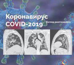 COVID-19: взгляд рентгенолога COVID-19: взгляд рентгенолога
