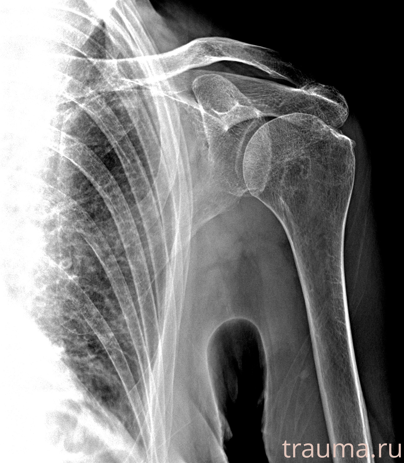 Рентген на дому: по вашему адресу приезжает врач-рентгенолог, травматолог-ортопед с мобильным рентгеновским аппаратом, проводит диагностику травмы или заболевания, делает необходимые рентгенограммы, дает рекомендации по дальнейшему лечению. Получить качественные снимки в домашних условиях возможно благодаря уникальной методике, разработанной МосРентген Центром для института  Склифосовского