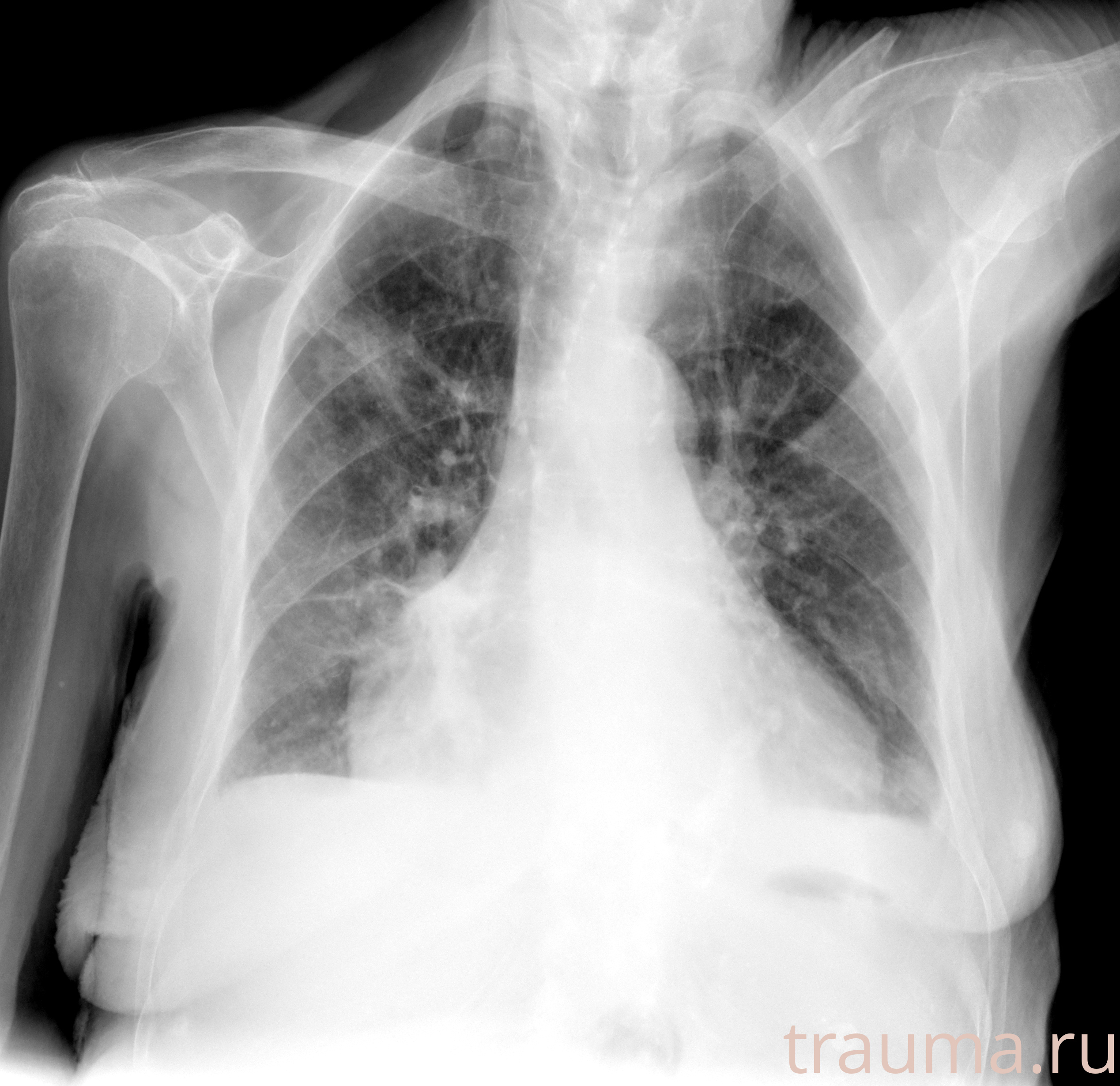 Рентген на дому: по вашему адресу приезжает врач-рентгенолог, травматолог-ортопед с мобильным рентгеновским аппаратом, проводит диагностику травмы или заболевания, делает необходимые рентгенограммы, дает рекомендации по дальнейшему лечению. Получить качественные снимки в домашних условиях возможно благодаря уникальной методике, разработанной МосРентген Центром для института  Склифосовского