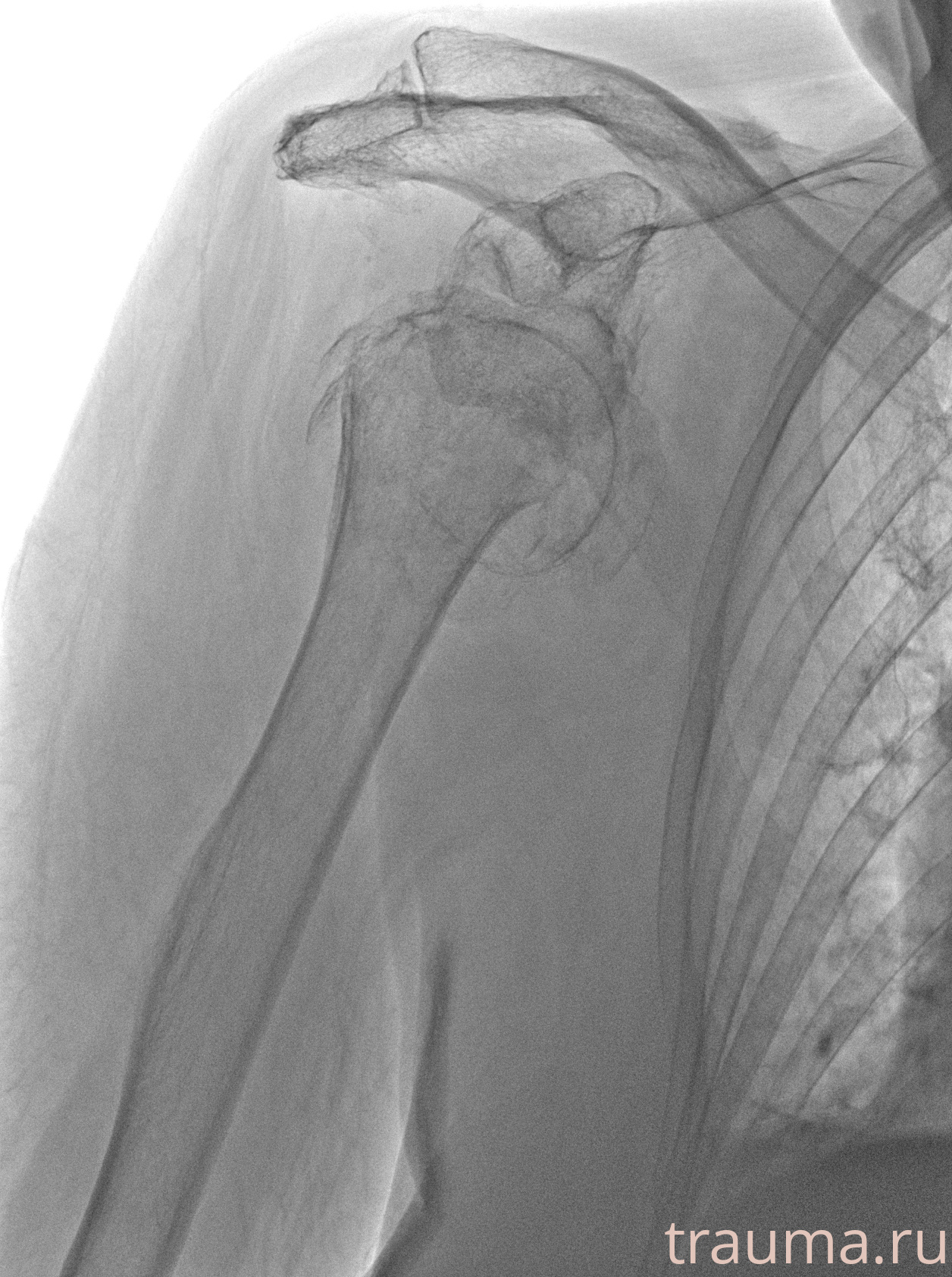 Рентген на дому: по вашему адресу приезжает врач-рентгенолог, травматолог-ортопед с мобильным рентгеновским аппаратом, проводит диагностику травмы или заболевания, делает необходимые рентгенограммы, дает рекомендации по дальнейшему лечению. Получить качественные снимки в домашних условиях возможно благодаря уникальной методике, разработанной МосРентген Центром для института  Склифосовского