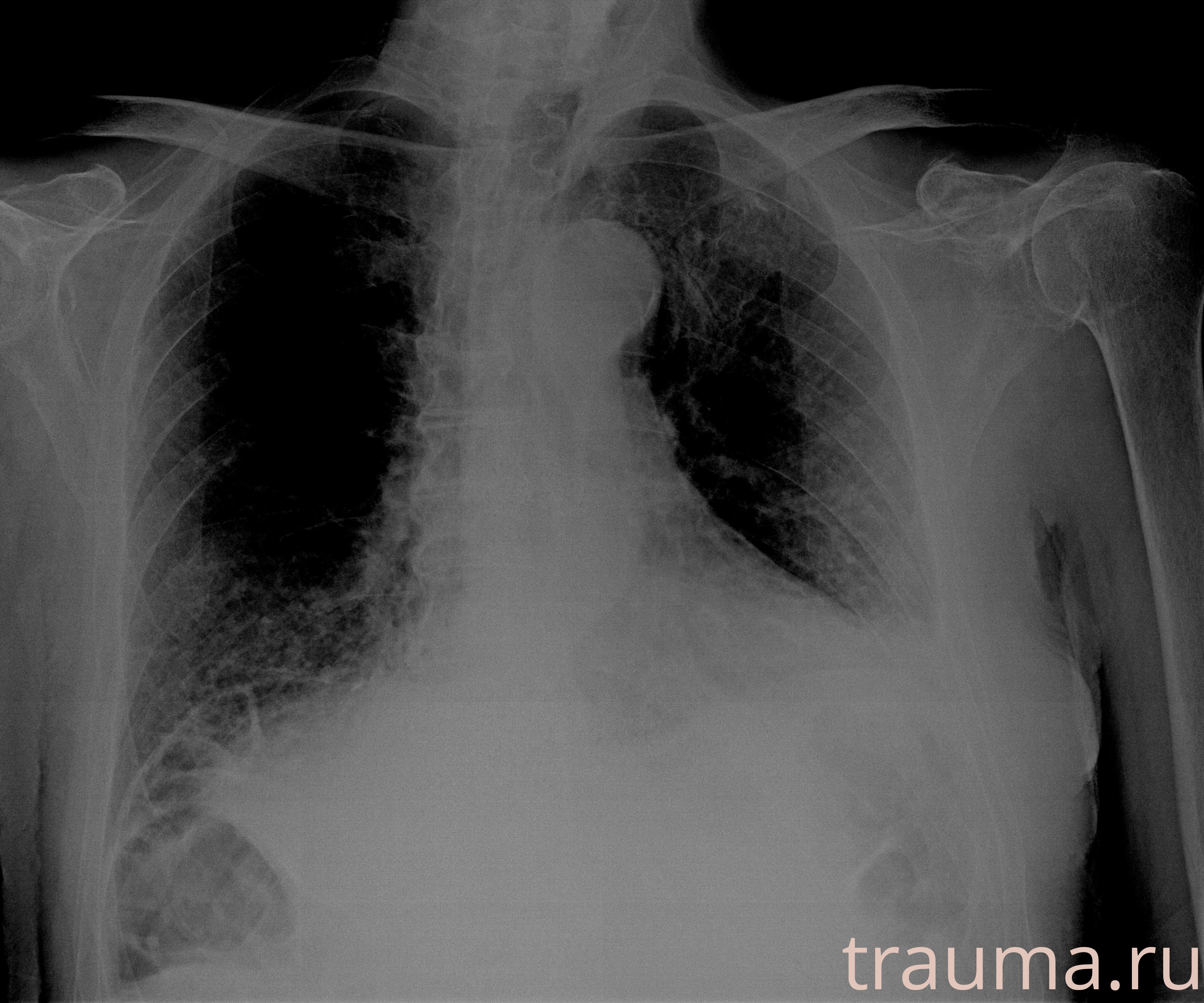 Рентген на дому: по вашему адресу приезжает врач-рентгенолог, травматолог-ортопед с мобильным рентгеновским аппаратом, проводит диагностику травмы или заболевания, делает необходимые рентгенограммы, дает рекомендации по дальнейшему лечению. Получить качественные снимки в домашних условиях возможно благодаря уникальной методике, разработанной МосРентген Центром для института  Склифосовского