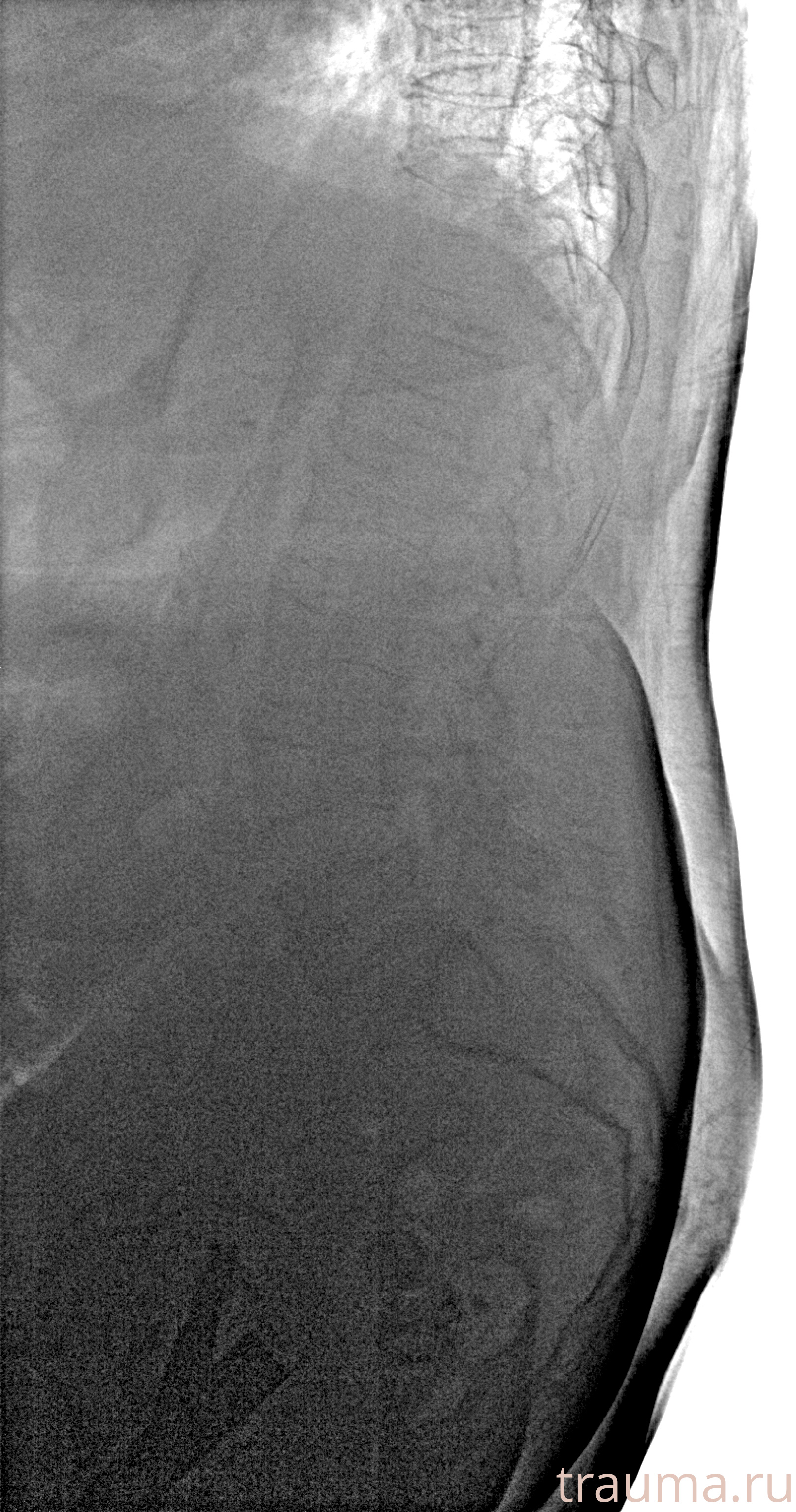 Рентген на дому: по вашему адресу приезжает врач-рентгенолог, травматолог-ортопед с мобильным рентгеновским аппаратом, проводит диагностику травмы или заболевания, делает необходимые рентгенограммы, дает рекомендации по дальнейшему лечению. Получить качественные снимки в домашних условиях возможно благодаря уникальной методике, разработанной МосРентген Центром для института  Склифосовского