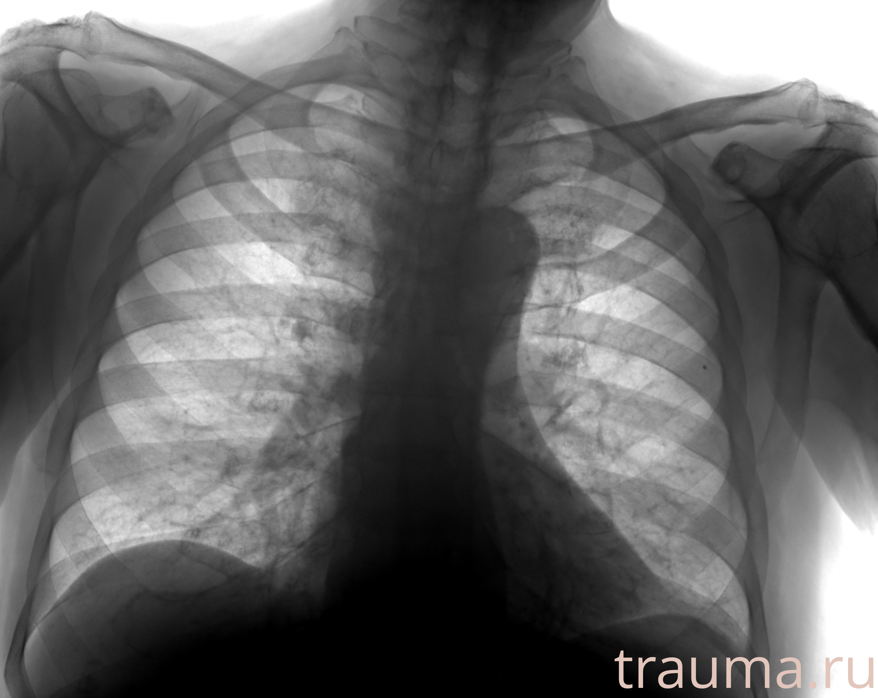Рентген на дому: по вашему адресу приезжает врач-рентгенолог, травматолог-ортопед с мобильным рентгеновским аппаратом, проводит диагностику травмы или заболевания, делает необходимые рентгенограммы, дает рекомендации по дальнейшему лечению. Получить качественные снимки в домашних условиях возможно благодаря уникальной методике, разработанной МосРентген Центром для института  Склифосовского