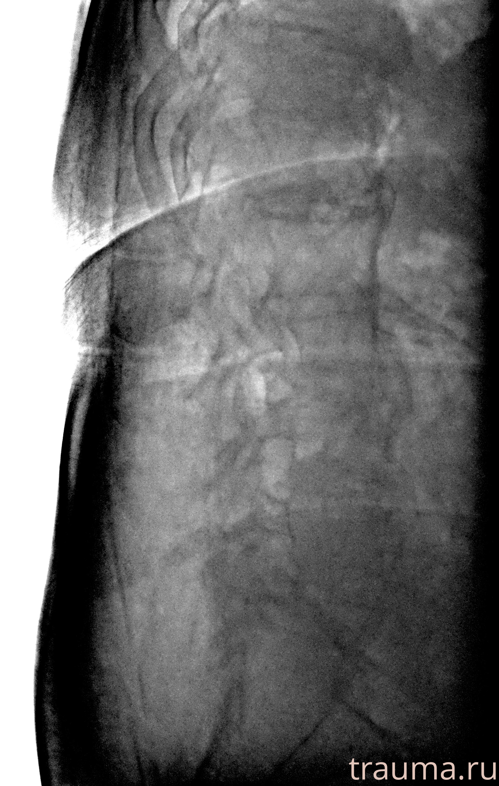 Рентген на дому: по вашему адресу приезжает врач-рентгенолог, травматолог-ортопед с мобильным рентгеновским аппаратом, проводит диагностику травмы или заболевания, делает необходимые рентгенограммы, дает рекомендации по дальнейшему лечению. Получить качественные снимки в домашних условиях возможно благодаря уникальной методике, разработанной МосРентген Центром для института  Склифосовского