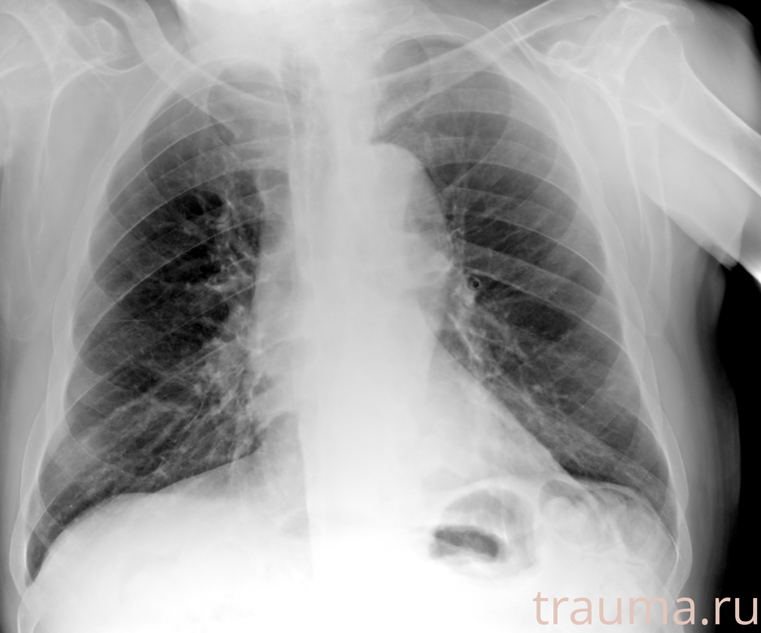 Рентген на дому: по вашему адресу приезжает врач-рентгенолог, травматолог-ортопед с мобильным рентгеновским аппаратом, проводит диагностику травмы или заболевания, делает необходимые рентгенограммы, дает рекомендации по дальнейшему лечению. Получить качественные снимки в домашних условиях возможно благодаря уникальной методике, разработанной МосРентген Центром для института  Склифосовского