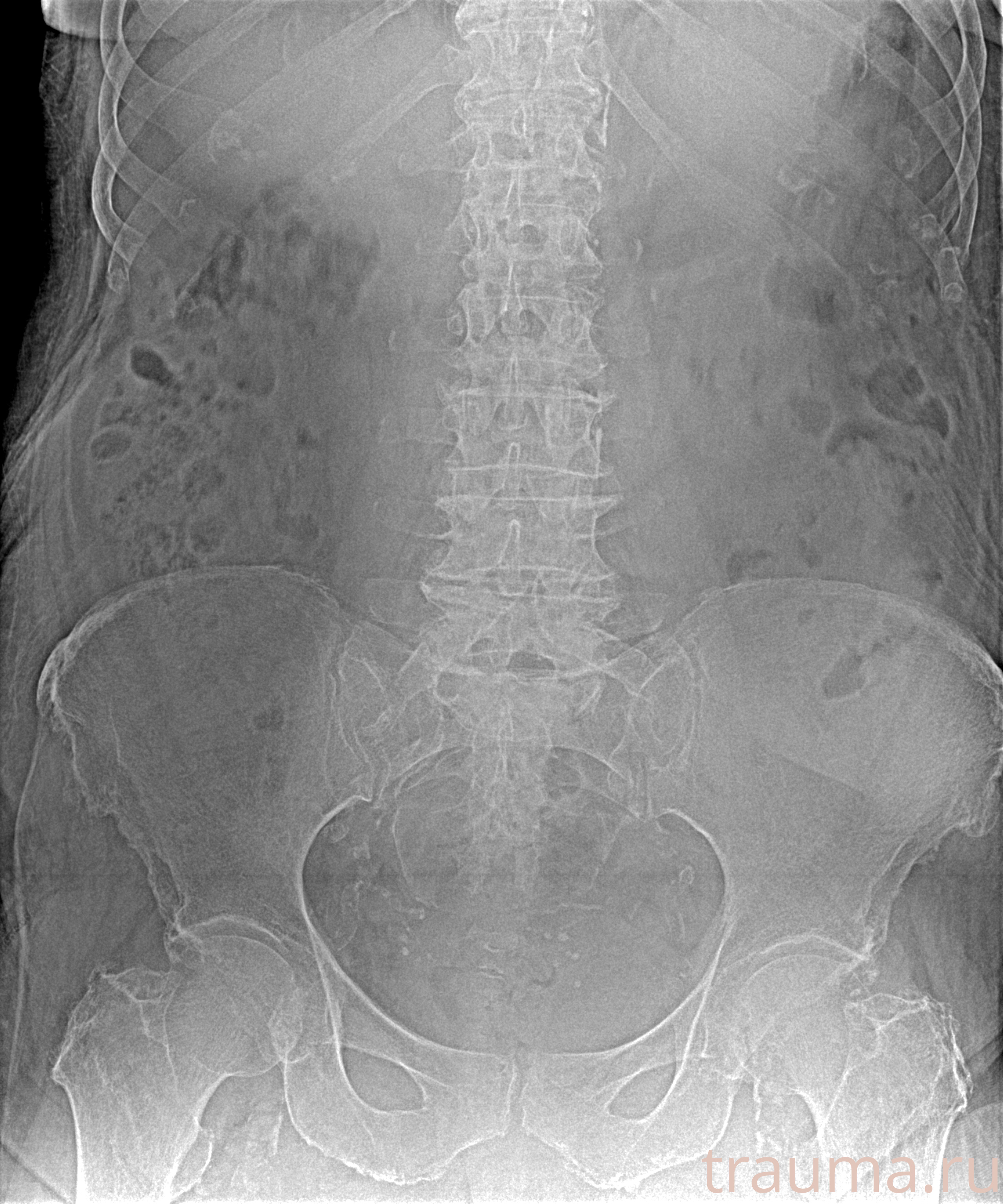 Рентген на дому: по вашему адресу приезжает врач-рентгенолог, травматолог-ортопед с мобильным рентгеновским аппаратом, проводит диагностику травмы или заболевания, делает необходимые рентгенограммы, дает рекомендации по дальнейшему лечению. Получить качественные снимки в домашних условиях возможно благодаря уникальной методике, разработанной МосРентген Центром для института  Склифосовского