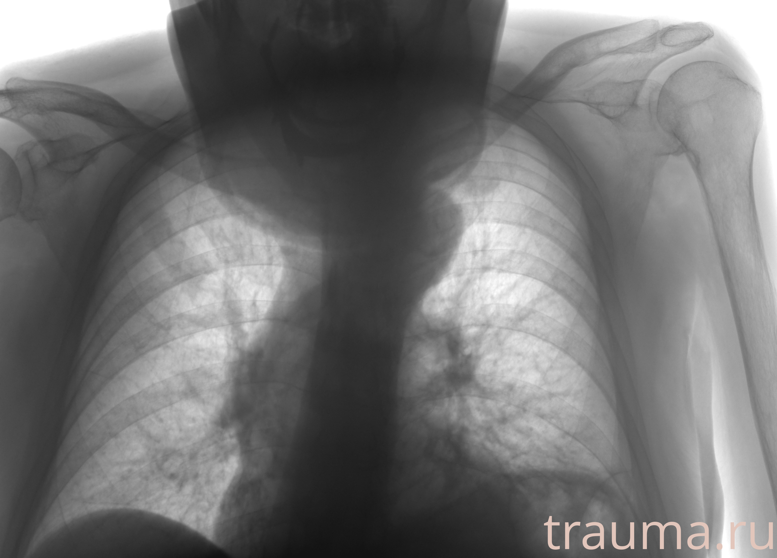 Рентген на дому: по вашему адресу приезжает врач-рентгенолог, травматолог-ортопед с мобильным рентгеновским аппаратом, проводит диагностику травмы или заболевания, делает необходимые рентгенограммы, дает рекомендации по дальнейшему лечению. Получить качественные снимки в домашних условиях возможно благодаря уникальной методике, разработанной МосРентген Центром для института  Склифосовского