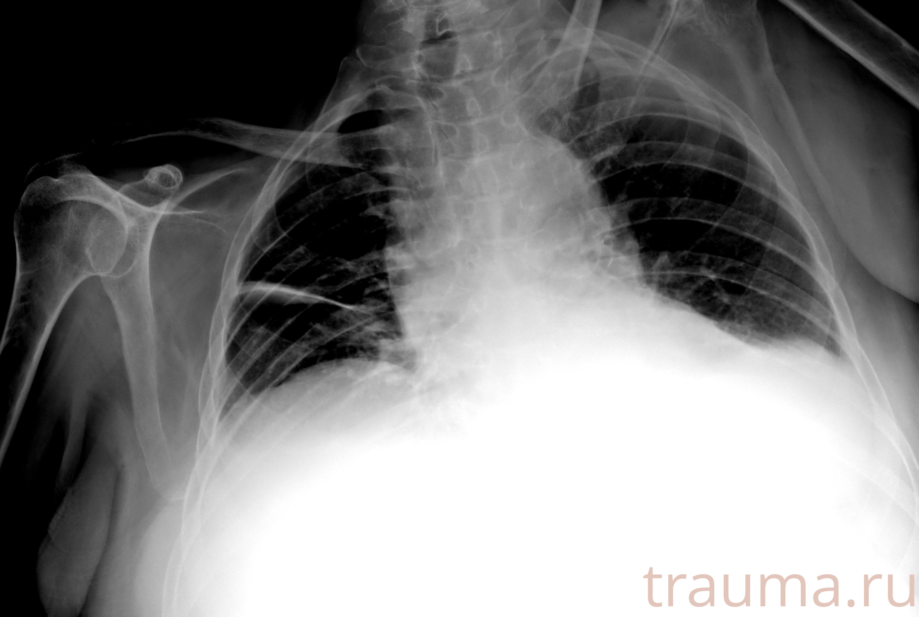 Рентген на дому: по вашему адресу приезжает врач-рентгенолог, травматолог-ортопед с мобильным рентгеновским аппаратом, проводит диагностику травмы или заболевания, делает необходимые рентгенограммы, дает рекомендации по дальнейшему лечению. Получить качественные снимки в домашних условиях возможно благодаря уникальной методике, разработанной МосРентген Центром для института  Склифосовского