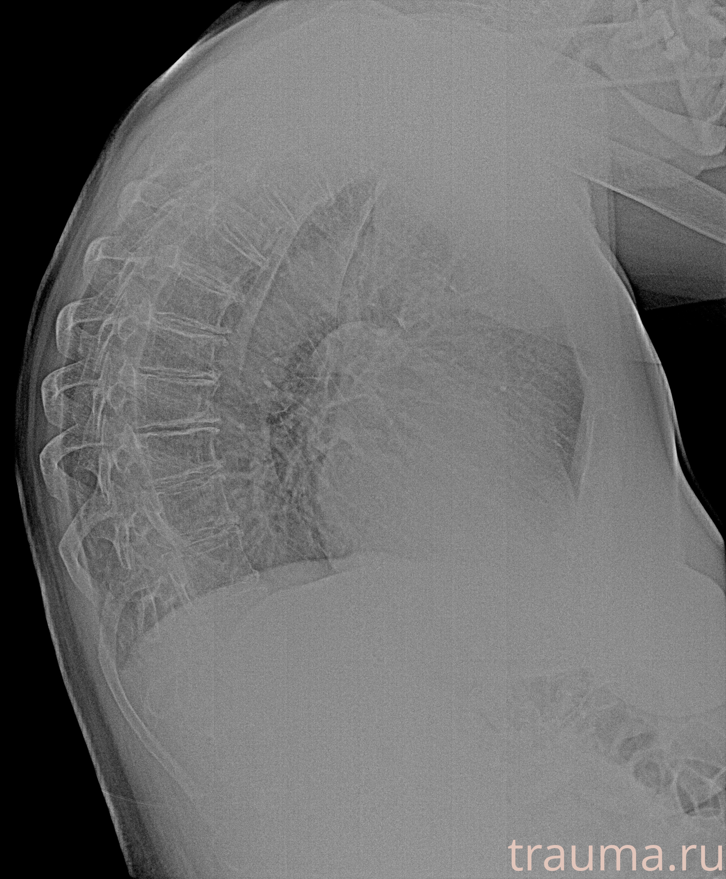 Рентген на дому: по вашему адресу приезжает врач-рентгенолог, травматолог-ортопед с мобильным рентгеновским аппаратом, проводит диагностику травмы или заболевания, делает необходимые рентгенограммы, дает рекомендации по дальнейшему лечению. Получить качественные снимки в домашних условиях возможно благодаря уникальной методике, разработанной МосРентген Центром для института  Склифосовского