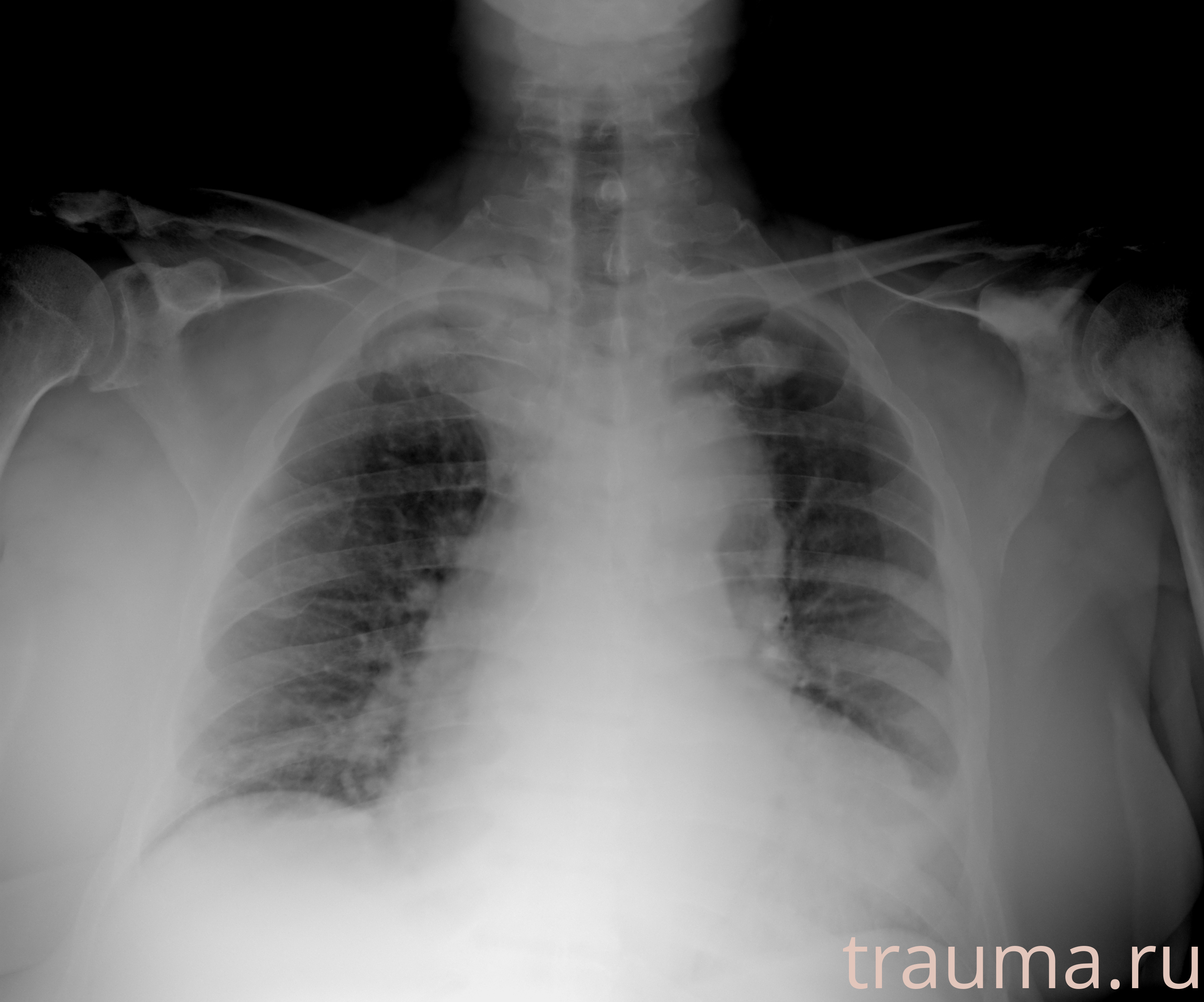 Рентген на дому: по вашему адресу приезжает врач-рентгенолог, травматолог-ортопед с мобильным рентгеновским аппаратом, проводит диагностику травмы или заболевания, делает необходимые рентгенограммы, дает рекомендации по дальнейшему лечению. Получить качественные снимки в домашних условиях возможно благодаря уникальной методике, разработанной МосРентген Центром для института  Склифосовского