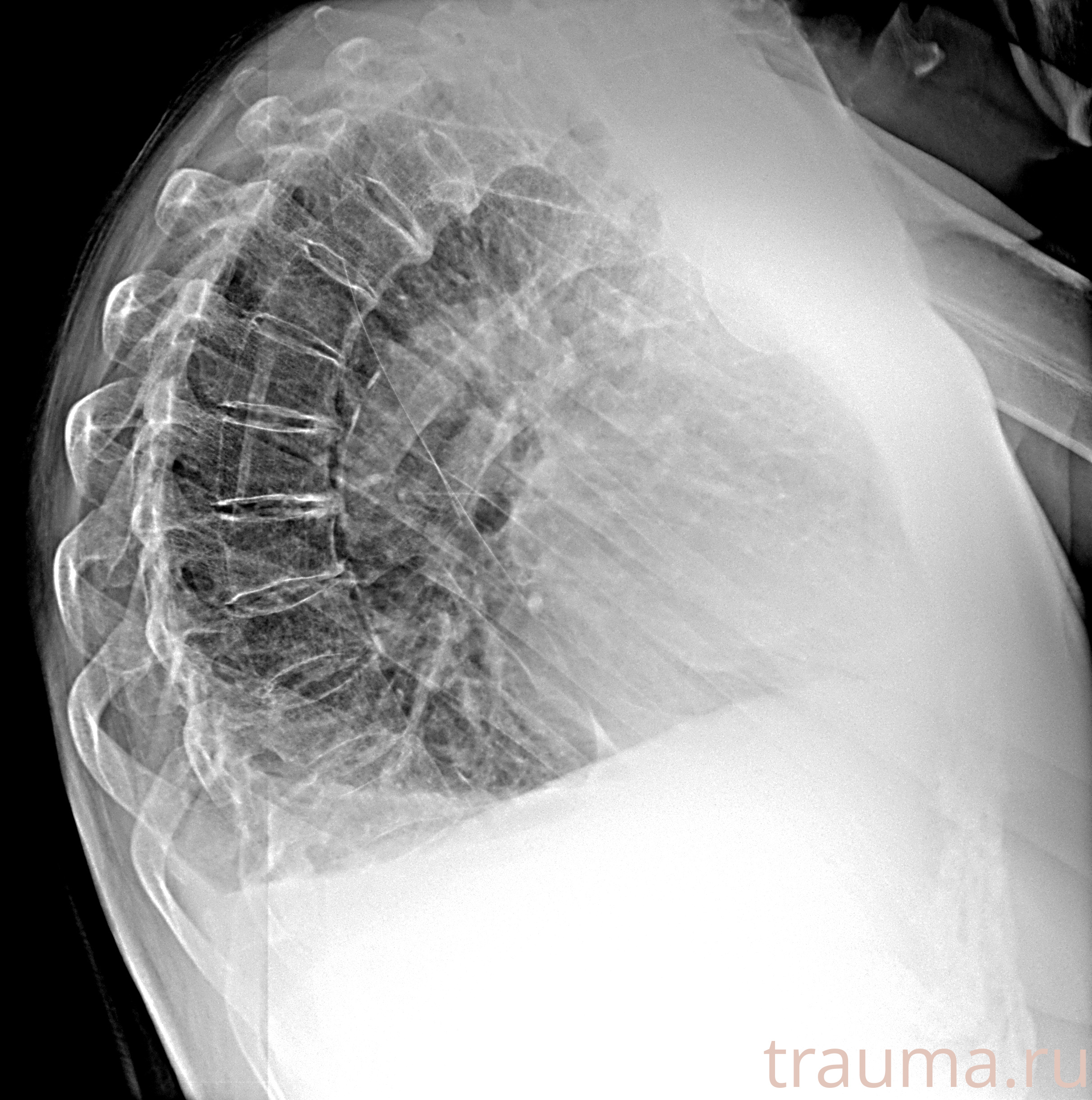 Рентген на дому: по вашему адресу приезжает врач-рентгенолог, травматолог-ортопед с мобильным рентгеновским аппаратом, проводит диагностику травмы или заболевания, делает необходимые рентгенограммы, дает рекомендации по дальнейшему лечению. Получить качественные снимки в домашних условиях возможно благодаря уникальной методике, разработанной МосРентген Центром для института  Склифосовского