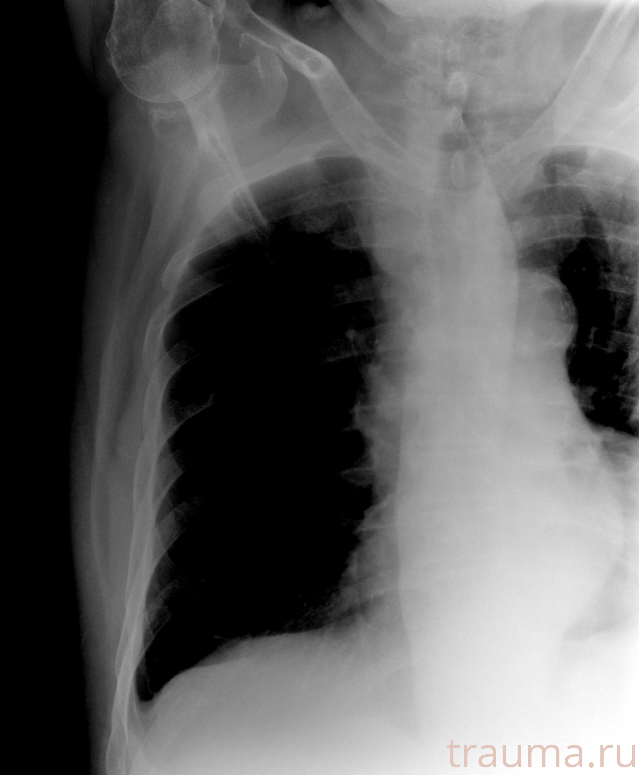 Рентген на дому: по вашему адресу приезжает врач-рентгенолог, травматолог-ортопед с мобильным рентгеновским аппаратом, проводит диагностику травмы или заболевания, делает необходимые рентгенограммы, дает рекомендации по дальнейшему лечению. Получить качественные снимки в домашних условиях возможно благодаря уникальной методике, разработанной МосРентген Центром для института  Склифосовского