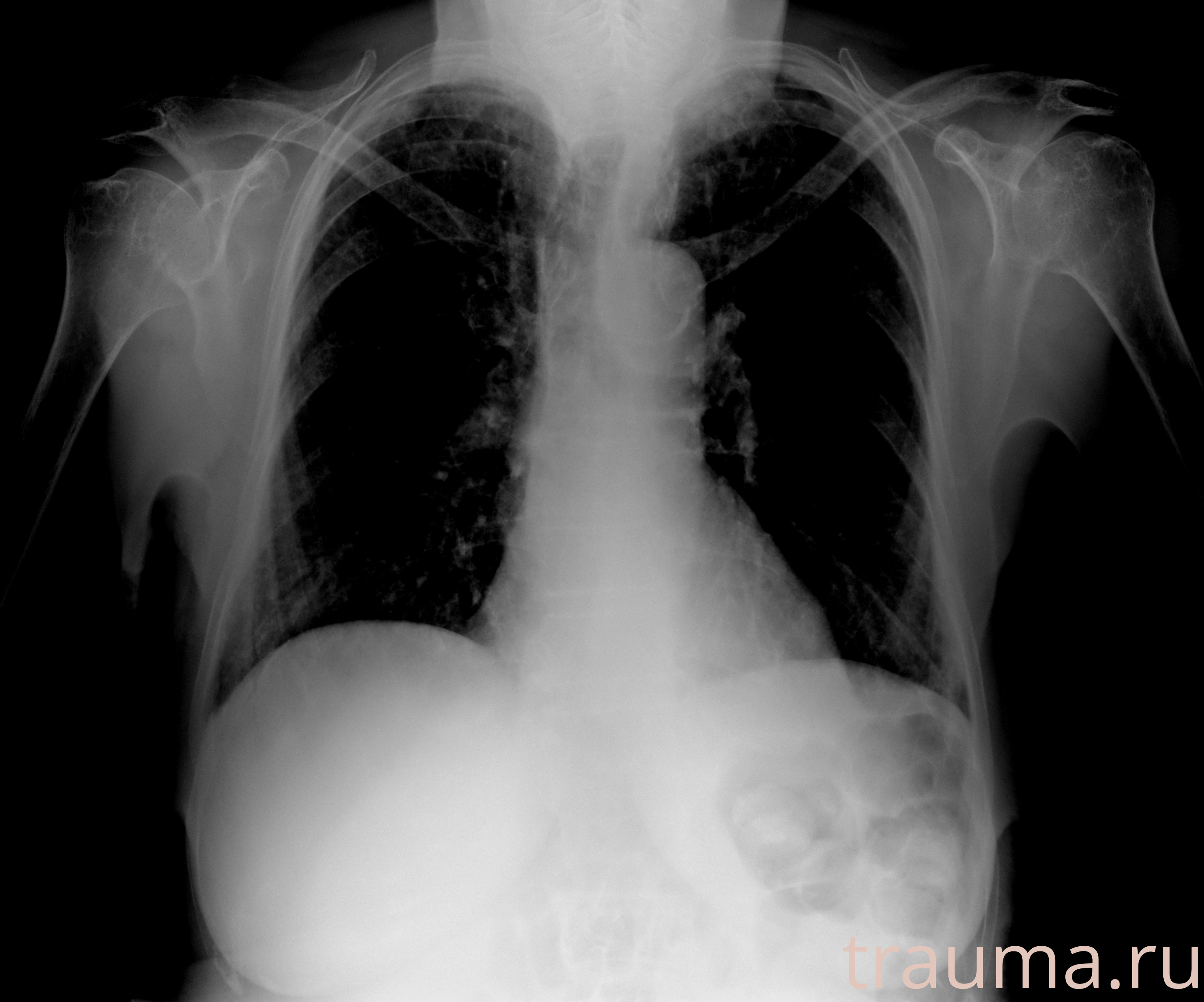 Рентген на дому: по вашему адресу приезжает врач-рентгенолог, травматолог-ортопед с мобильным рентгеновским аппаратом, проводит диагностику травмы или заболевания, делает необходимые рентгенограммы, дает рекомендации по дальнейшему лечению. Получить качественные снимки в домашних условиях возможно благодаря уникальной методике, разработанной МосРентген Центром для института  Склифосовского