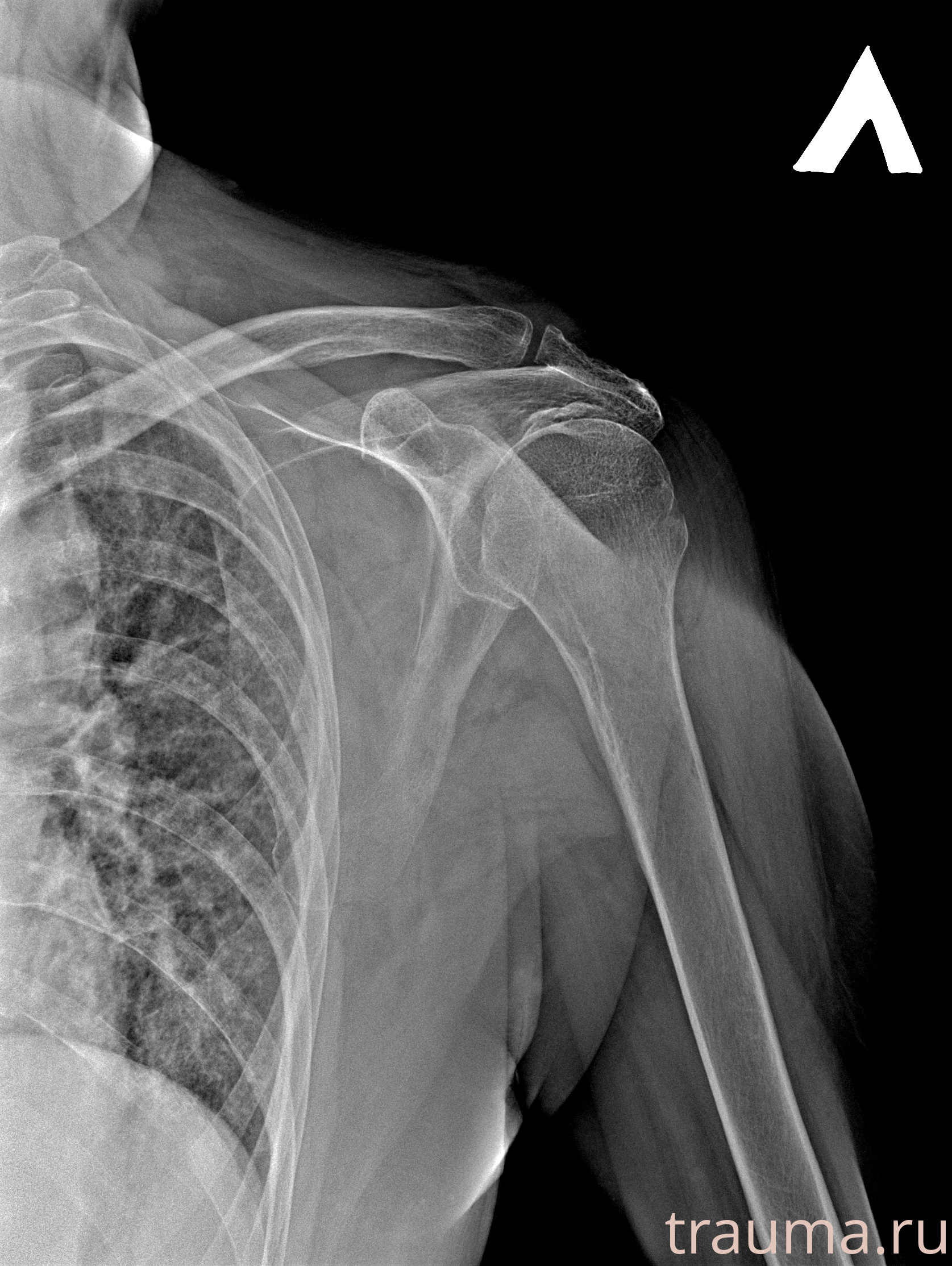 Рентген на дому: по вашему адресу приезжает врач-рентгенолог, травматолог-ортопед с мобильным рентгеновским аппаратом, проводит диагностику травмы или заболевания, делает необходимые рентгенограммы, дает рекомендации по дальнейшему лечению. Получить качественные снимки в домашних условиях возможно благодаря уникальной методике, разработанной МосРентген Центром для института  Склифосовского