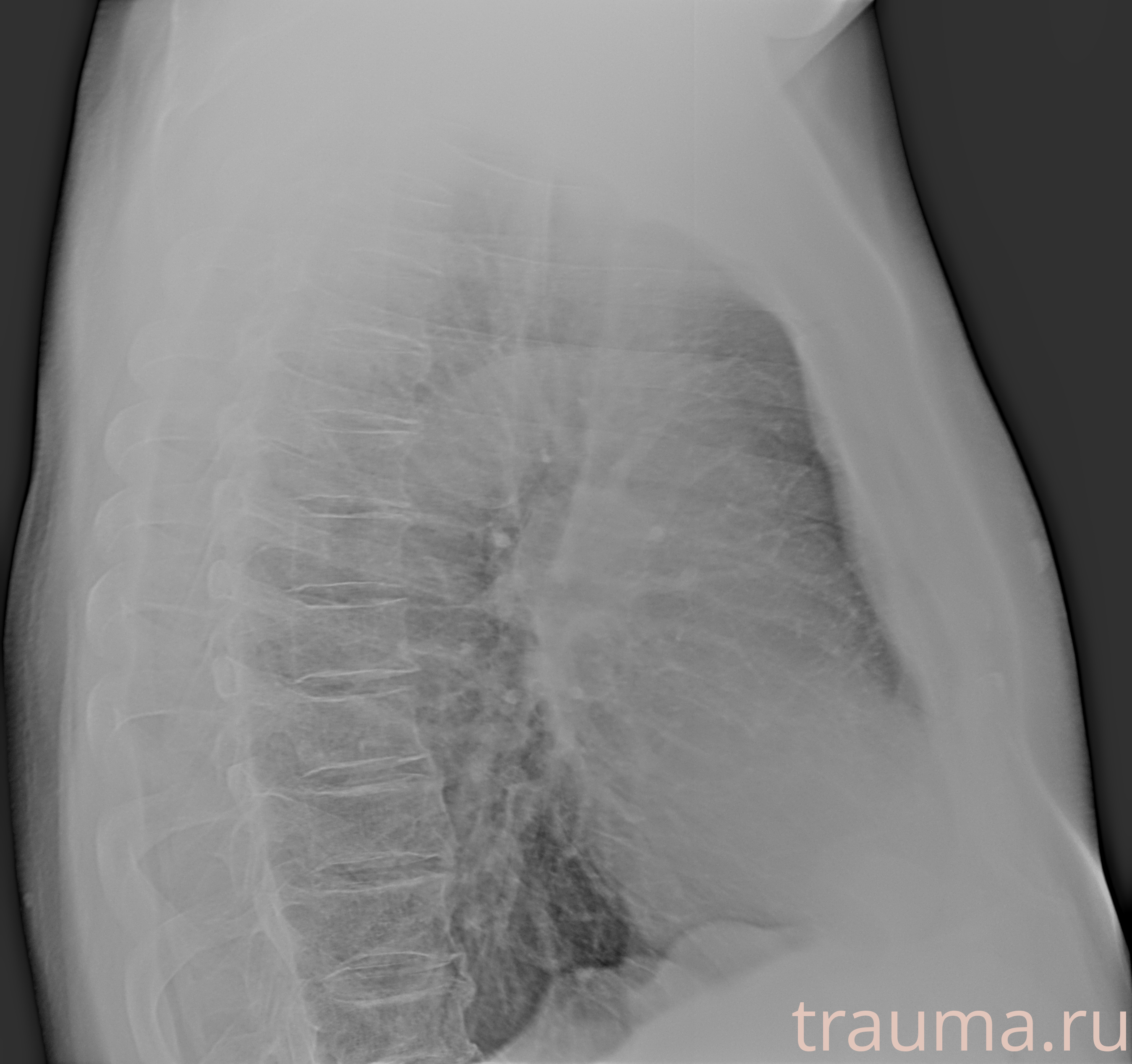 Рентген на дому: по вашему адресу приезжает врач-рентгенолог, травматолог-ортопед с мобильным рентгеновским аппаратом, проводит диагностику травмы или заболевания, делает необходимые рентгенограммы, дает рекомендации по дальнейшему лечению. Получить качественные снимки в домашних условиях возможно благодаря уникальной методике, разработанной МосРентген Центром для института  Склифосовского