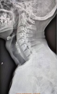 Рыбак проглотил крючок. Рыбак проглотил крючок.