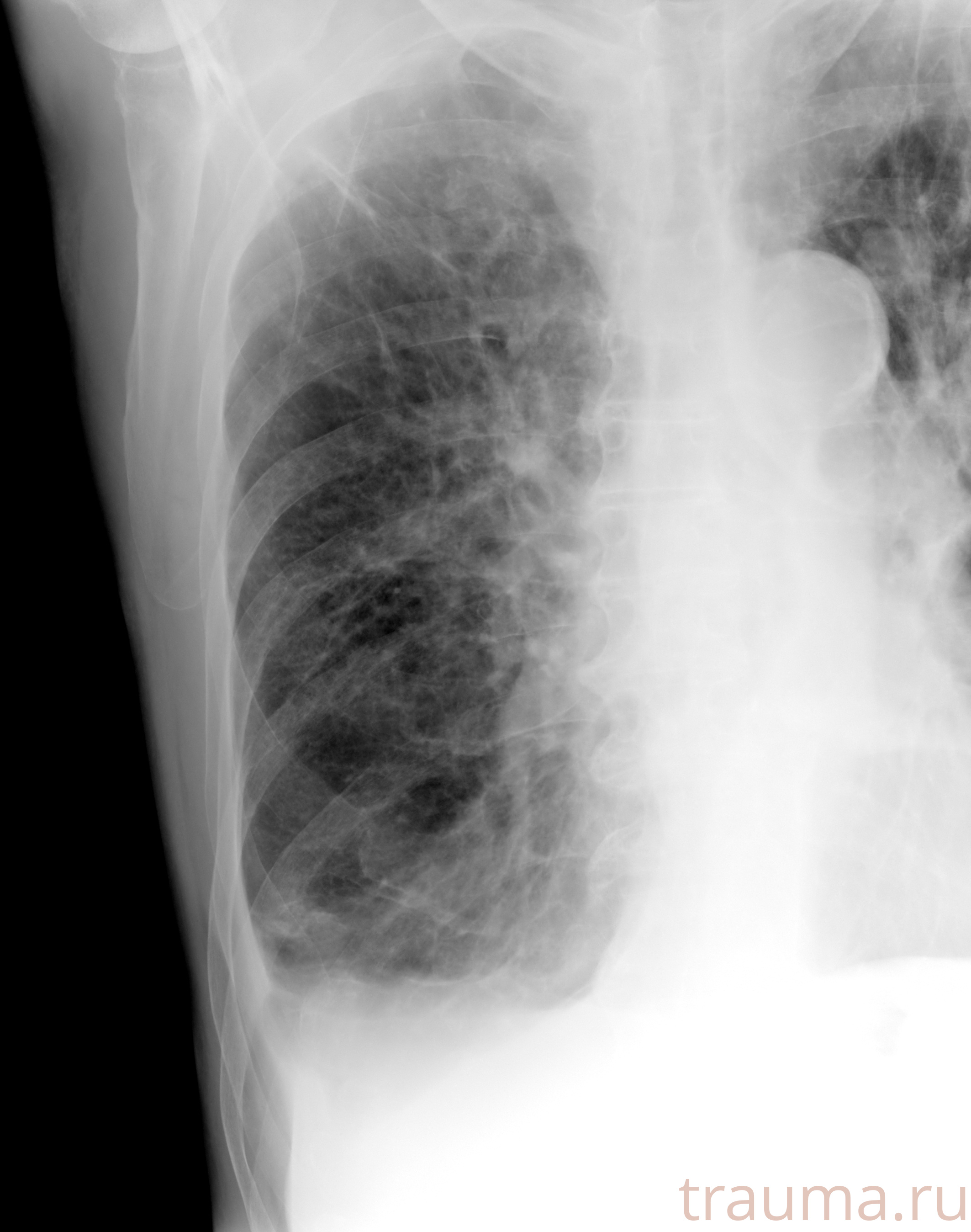 Рентген на дому: по вашему адресу приезжает врач-рентгенолог, травматолог-ортопед с мобильным рентгеновским аппаратом, проводит диагностику травмы или заболевания, делает необходимые рентгенограммы, дает рекомендации по дальнейшему лечению. Получить качественные снимки в домашних условиях возможно благодаря уникальной методике, разработанной МосРентген Центром для института  Склифосовского