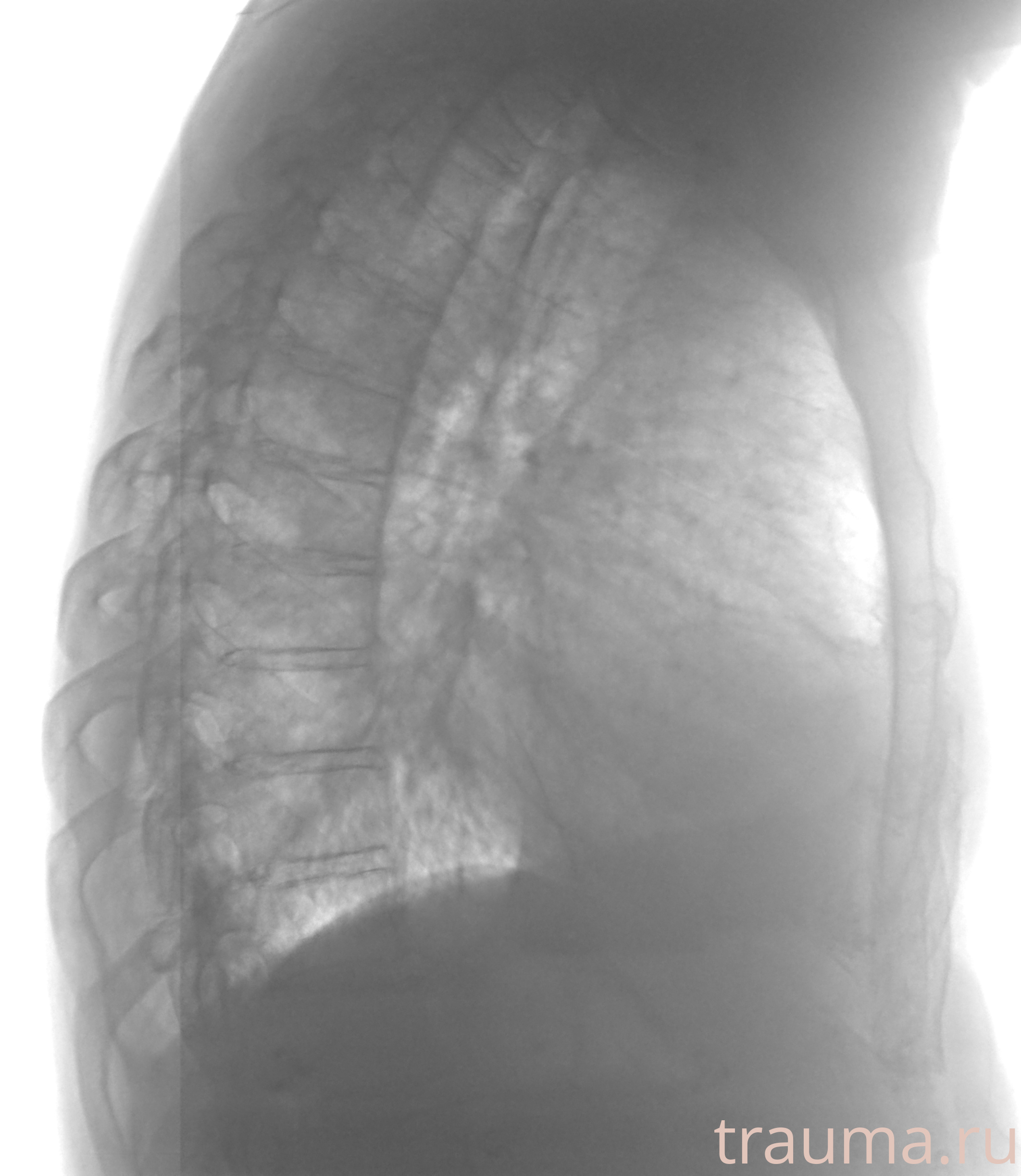 Рентген на дому: по вашему адресу приезжает врач-рентгенолог, травматолог-ортопед с мобильным рентгеновским аппаратом, проводит диагностику травмы или заболевания, делает необходимые рентгенограммы, дает рекомендации по дальнейшему лечению. Получить качественные снимки в домашних условиях возможно благодаря уникальной методике, разработанной МосРентген Центром для института  Склифосовского