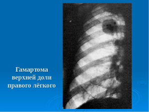 Рентген на дому