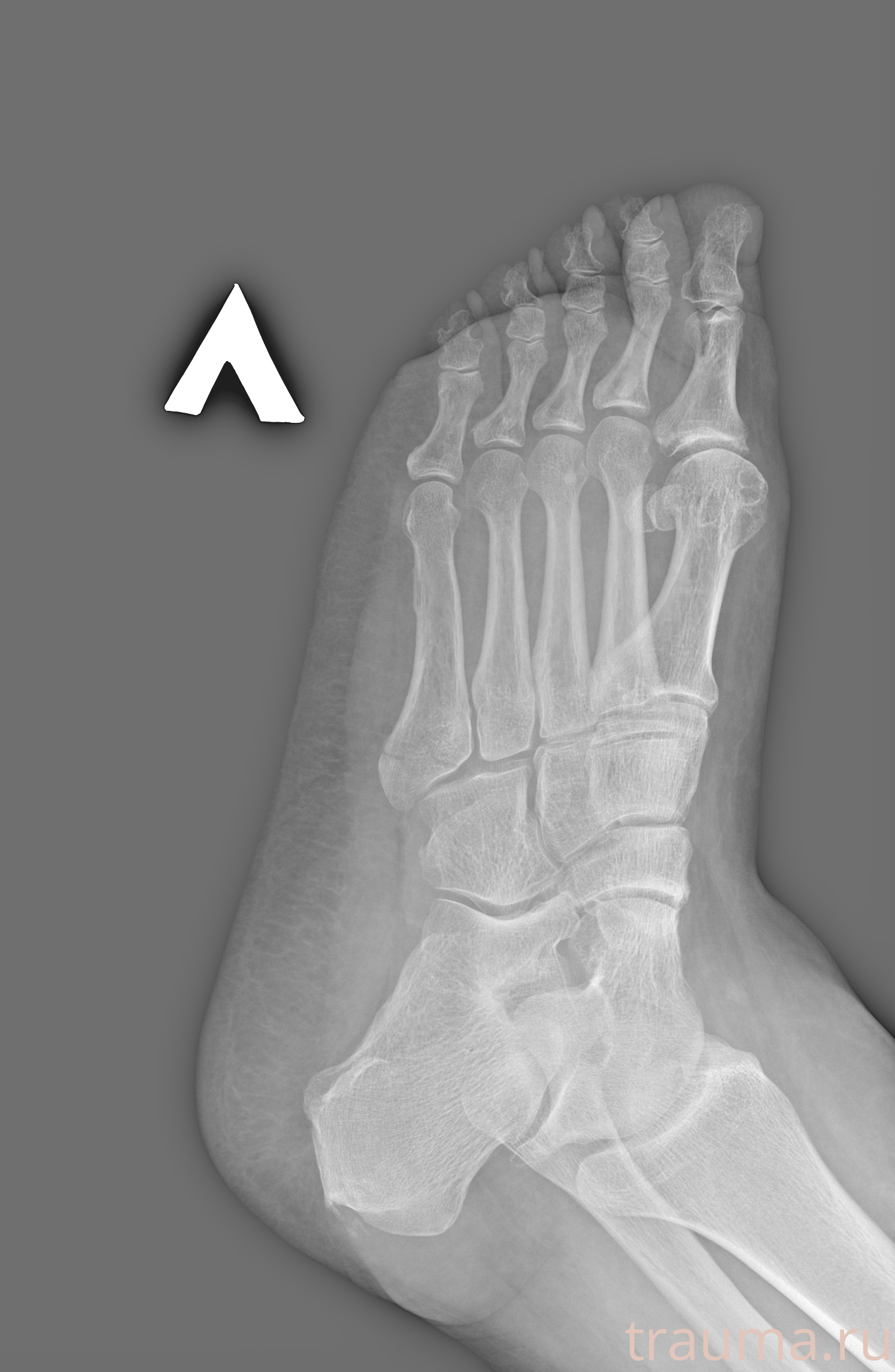 Рентген на дому: по вашему адресу приезжает врач-рентгенолог, травматолог-ортопед с мобильным рентгеновским аппаратом, проводит диагностику травмы или заболевания, делает необходимые рентгенограммы, дает рекомендации по дальнейшему лечению. Получить качественные снимки в домашних условиях возможно благодаря уникальной методике, разработанной МосРентген Центром для института  Склифосовского