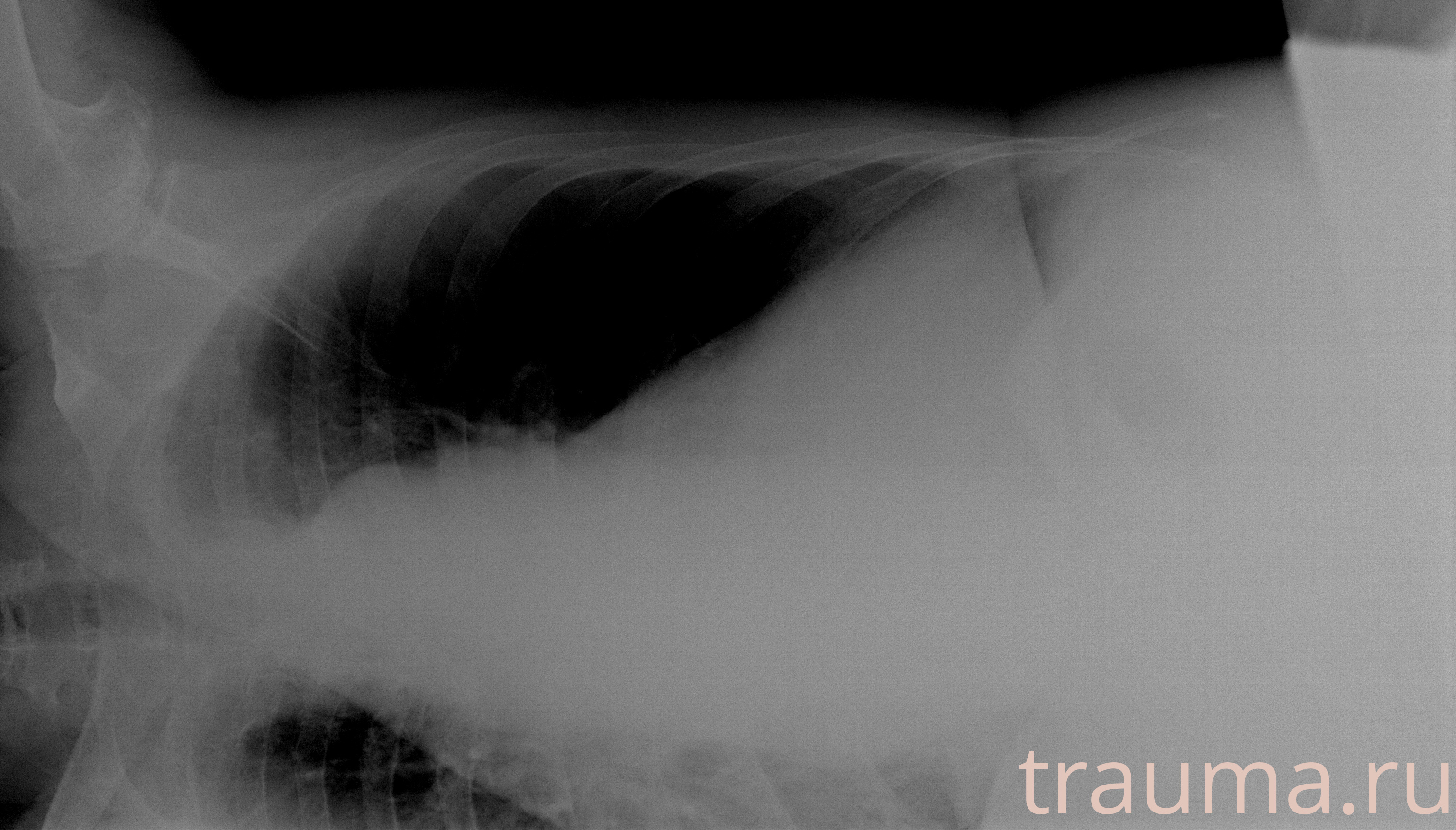 Рентген на дому: по вашему адресу приезжает врач-рентгенолог, травматолог-ортопед с мобильным рентгеновским аппаратом, проводит диагностику травмы или заболевания, делает необходимые рентгенограммы, дает рекомендации по дальнейшему лечению. Получить качественные снимки в домашних условиях возможно благодаря уникальной методике, разработанной МосРентген Центром для института  Склифосовского