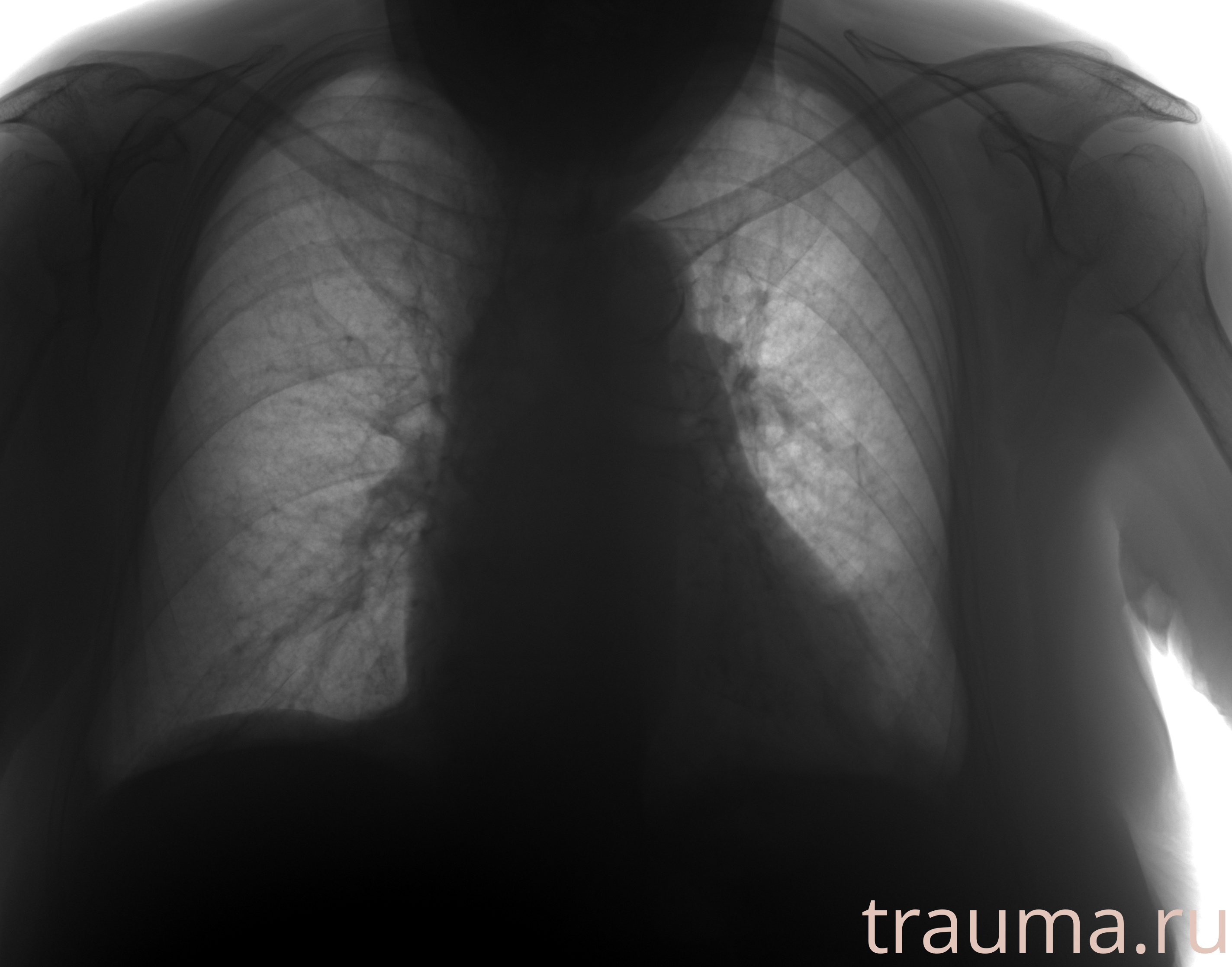 Рентген на дому: по вашему адресу приезжает врач-рентгенолог, травматолог-ортопед с мобильным рентгеновским аппаратом, проводит диагностику травмы или заболевания, делает необходимые рентгенограммы, дает рекомендации по дальнейшему лечению. Получить качественные снимки в домашних условиях возможно благодаря уникальной методике, разработанной МосРентген Центром для института  Склифосовского