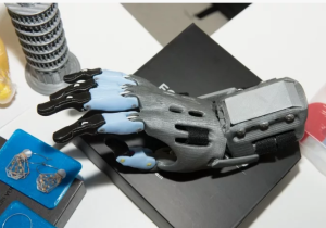 Новые технологии реконструкции пальцев кисти с применением 3D-печати Новые технологии реконструкции пальцев кисти с применением 3D-печати