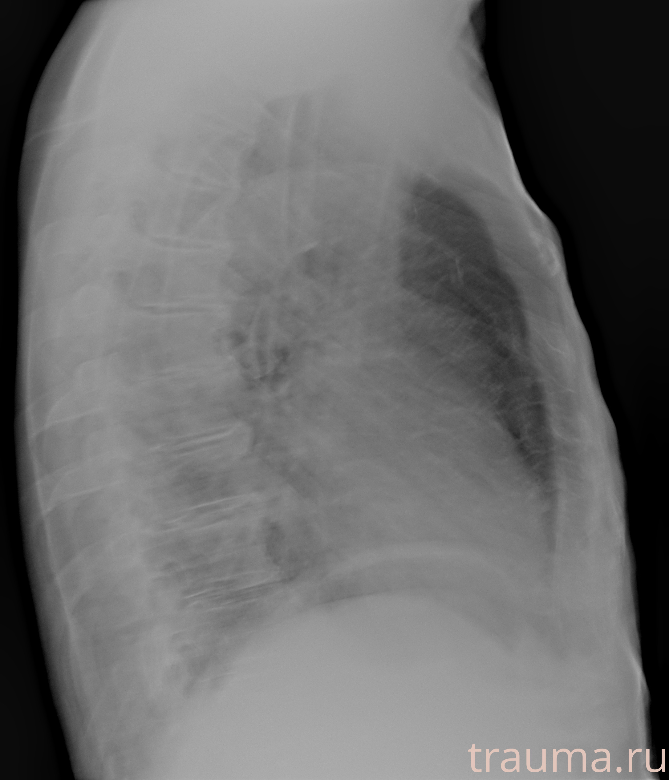 Рентген на дому: по вашему адресу приезжает врач-рентгенолог, травматолог-ортопед с мобильным рентгеновским аппаратом, проводит диагностику травмы или заболевания, делает необходимые рентгенограммы, дает рекомендации по дальнейшему лечению. Получить качественные снимки в домашних условиях возможно благодаря уникальной методике, разработанной МосРентген Центром для института  Склифосовского