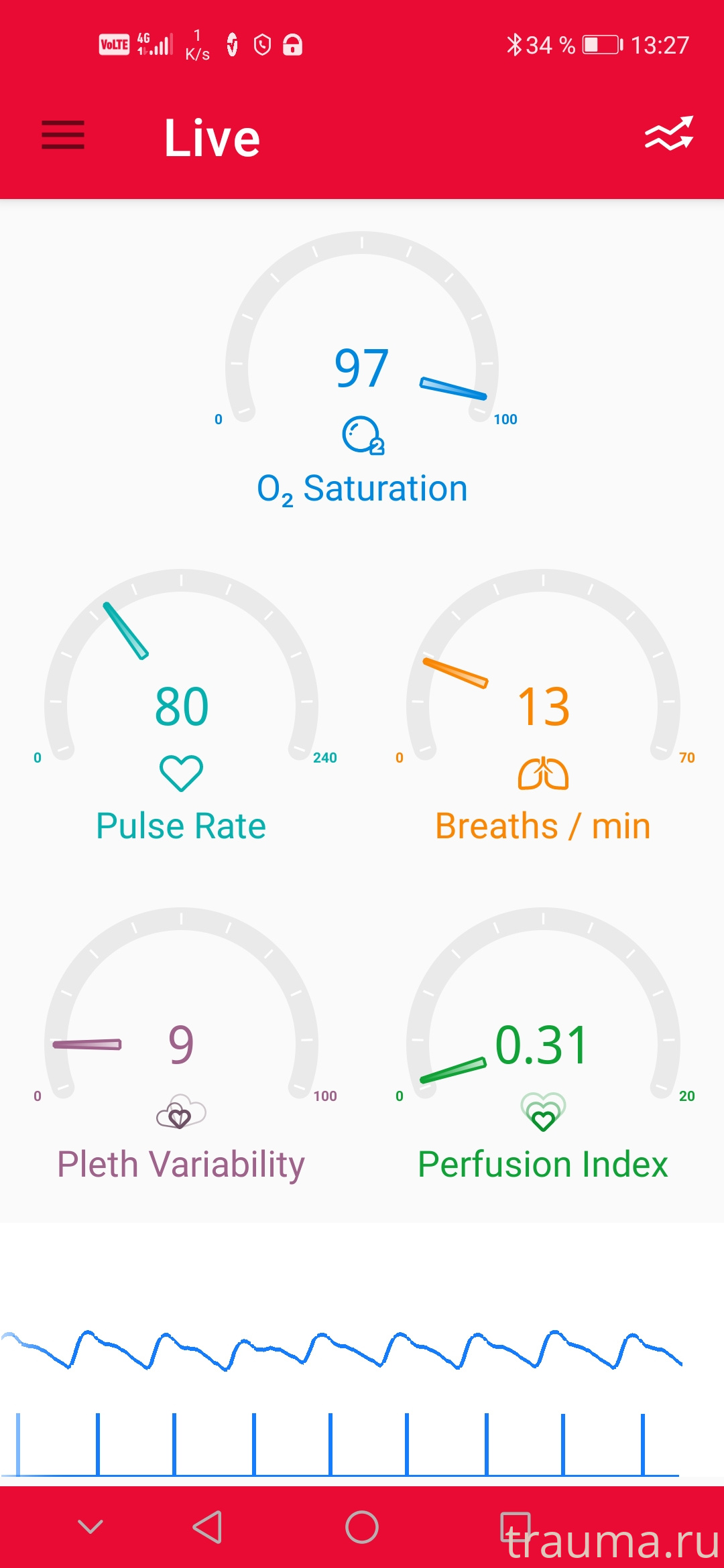 Рентген на дому: по вашему адресу приезжает врач-рентгенолог, травматолог-ортопед с мобильным рентгеновским аппаратом, проводит диагностику травмы или заболевания, делает необходимые рентгенограммы, дает рекомендации по дальнейшему лечению. Получить качественные снимки в домашних условиях возможно благодаря уникальной методике, разработанной МосРентген Центром для института  Склифосовского