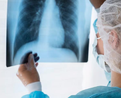 Как выглядит рак легких на рентгене: камчатские медики информируют