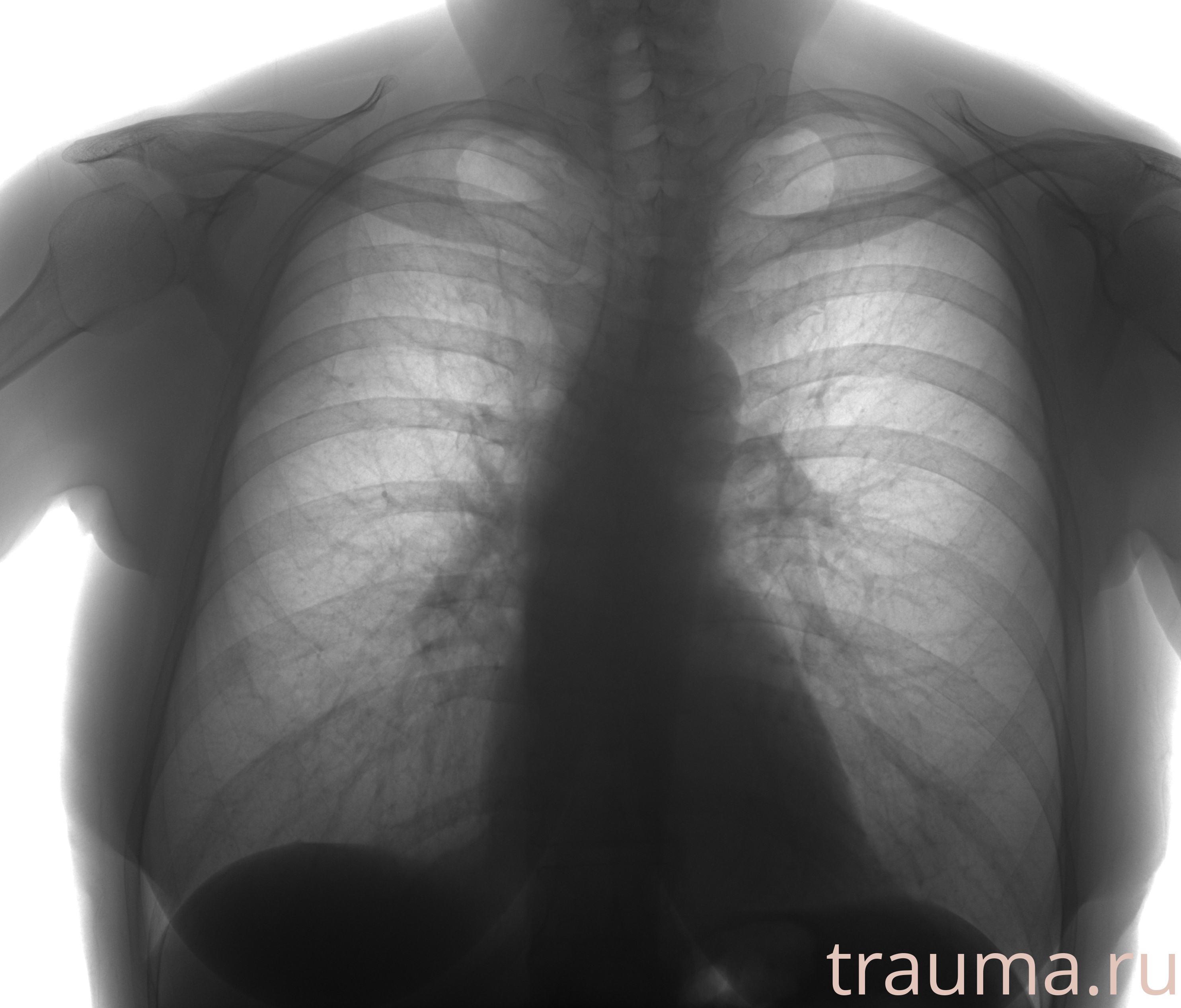 Рентген на дому: по вашему адресу приезжает врач-рентгенолог, травматолог-ортопед с мобильным рентгеновским аппаратом, проводит диагностику травмы или заболевания, делает необходимые рентгенограммы, дает рекомендации по дальнейшему лечению. Получить качественные снимки в домашних условиях возможно благодаря уникальной методике, разработанной МосРентген Центром для института  Склифосовского