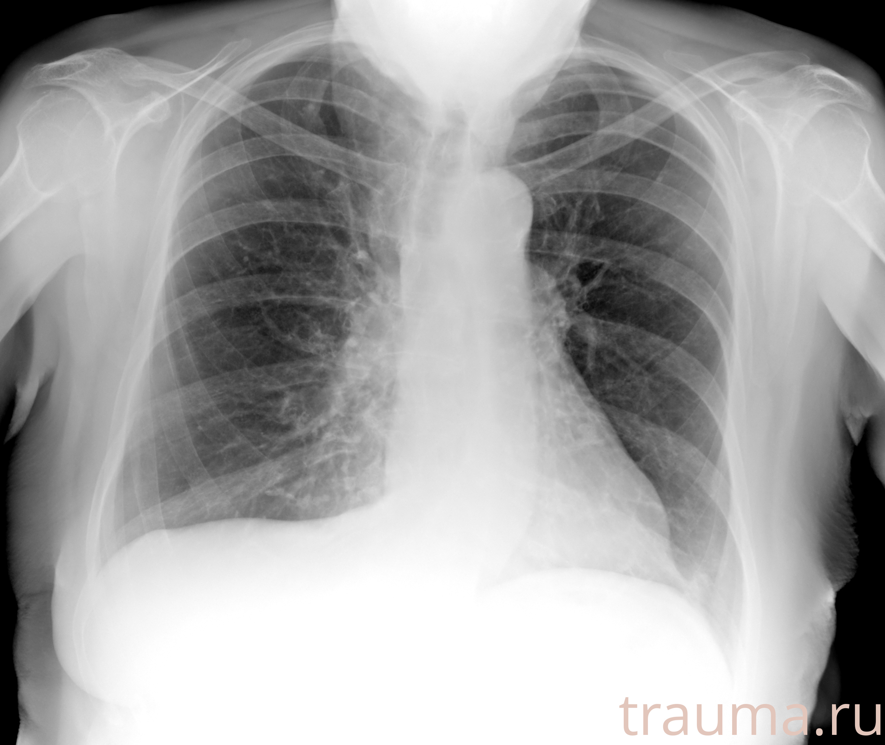 Рентген на дому: по вашему адресу приезжает врач-рентгенолог, травматолог-ортопед с мобильным рентгеновским аппаратом, проводит диагностику травмы или заболевания, делает необходимые рентгенограммы, дает рекомендации по дальнейшему лечению. Получить качественные снимки в домашних условиях возможно благодаря уникальной методике, разработанной МосРентген Центром для института  Склифосовского