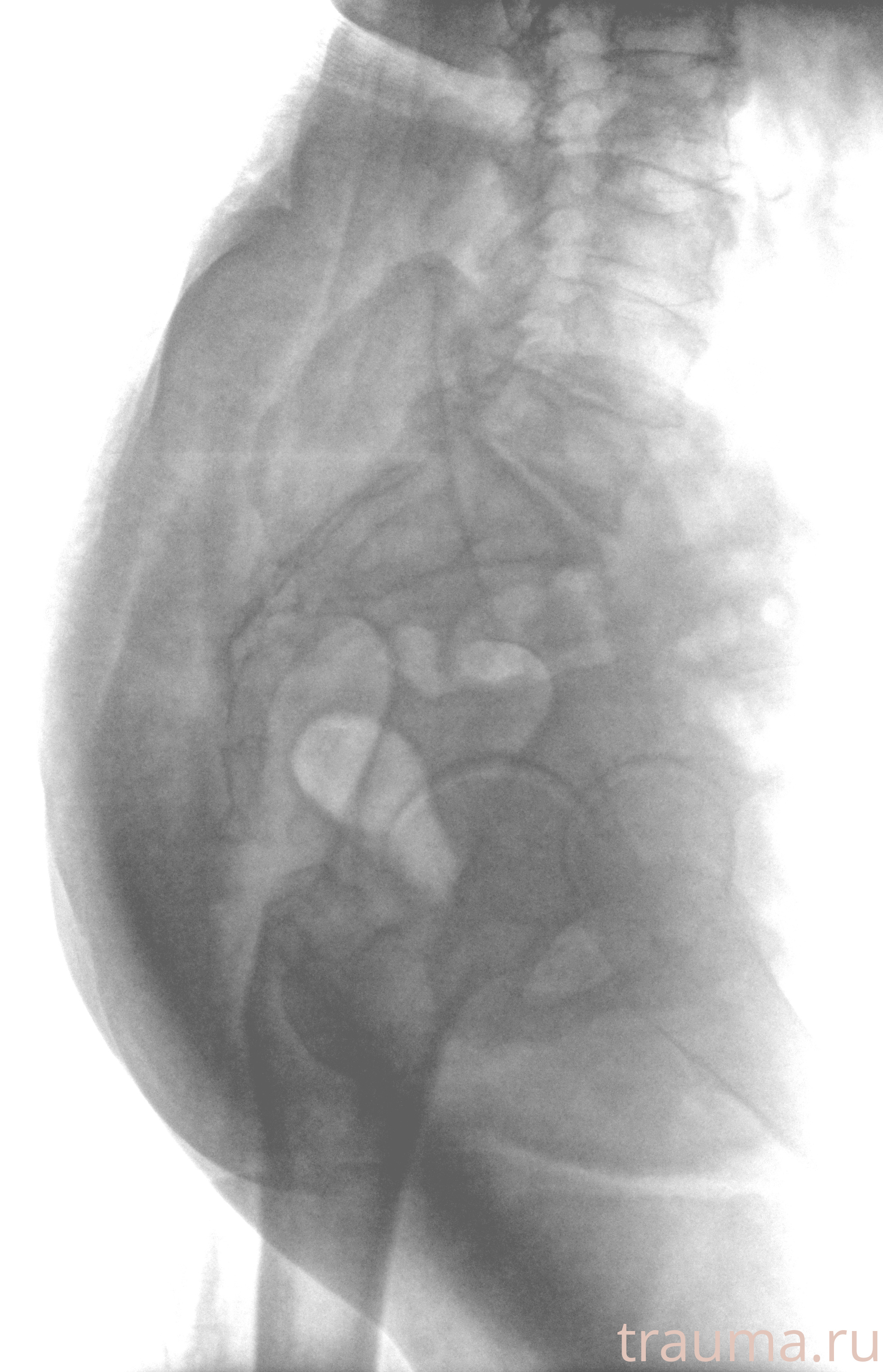 Рентген на дому: по вашему адресу приезжает врач-рентгенолог, травматолог-ортопед с мобильным рентгеновским аппаратом, проводит диагностику травмы или заболевания, делает необходимые рентгенограммы, дает рекомендации по дальнейшему лечению. Получить качественные снимки в домашних условиях возможно благодаря уникальной методике, разработанной МосРентген Центром для института  Склифосовского