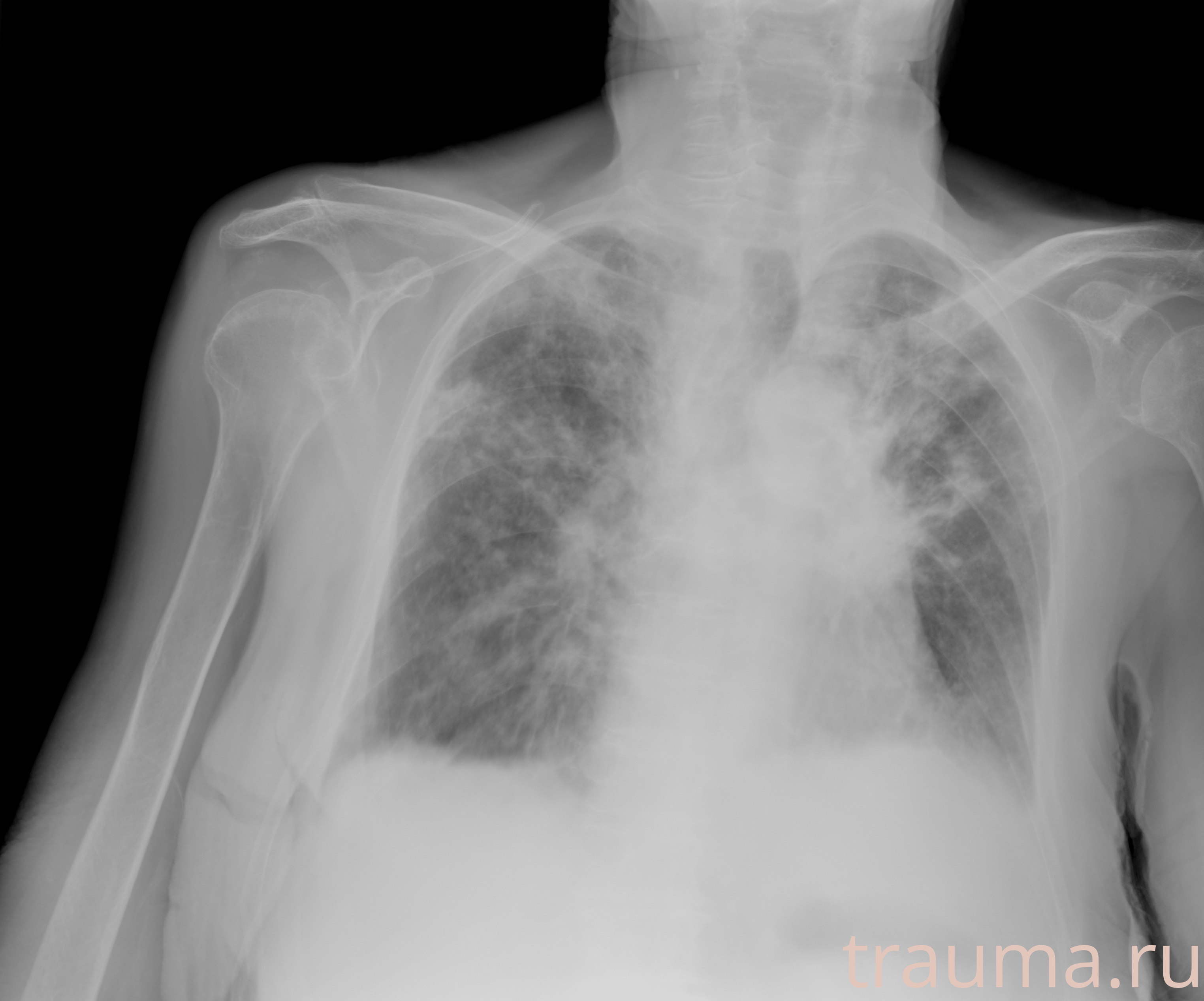 Рентген на дому: по вашему адресу приезжает врач-рентгенолог, травматолог-ортопед с мобильным рентгеновским аппаратом, проводит диагностику травмы или заболевания, делает необходимые рентгенограммы, дает рекомендации по дальнейшему лечению. Получить качественные снимки в домашних условиях возможно благодаря уникальной методике, разработанной МосРентген Центром для института  Склифосовского