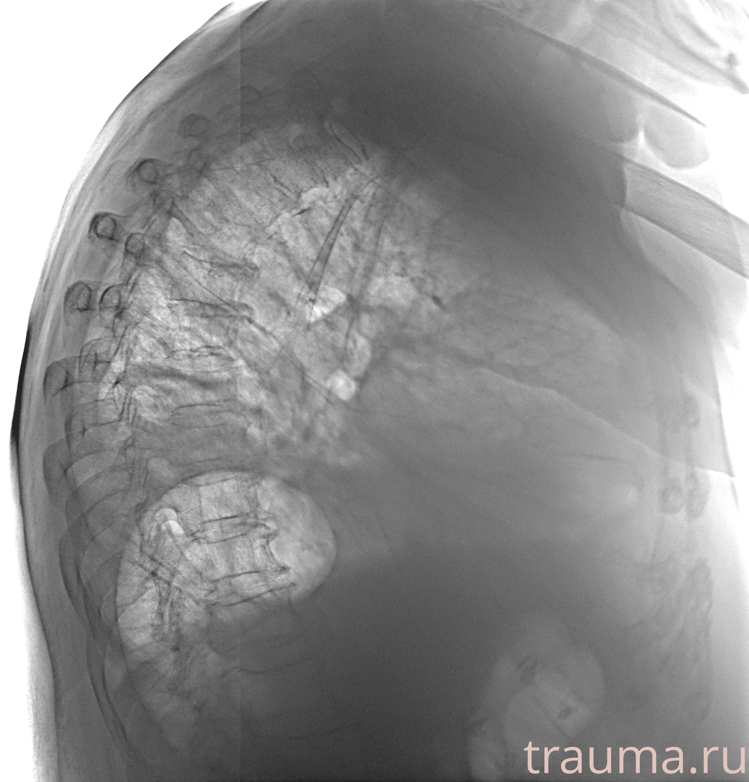 Рентген на дому: по вашему адресу приезжает врач-рентгенолог, травматолог-ортопед с мобильным рентгеновским аппаратом, проводит диагностику травмы или заболевания, делает необходимые рентгенограммы, дает рекомендации по дальнейшему лечению. Получить качественные снимки в домашних условиях возможно благодаря уникальной методике, разработанной МосРентген Центром для института  Склифосовского