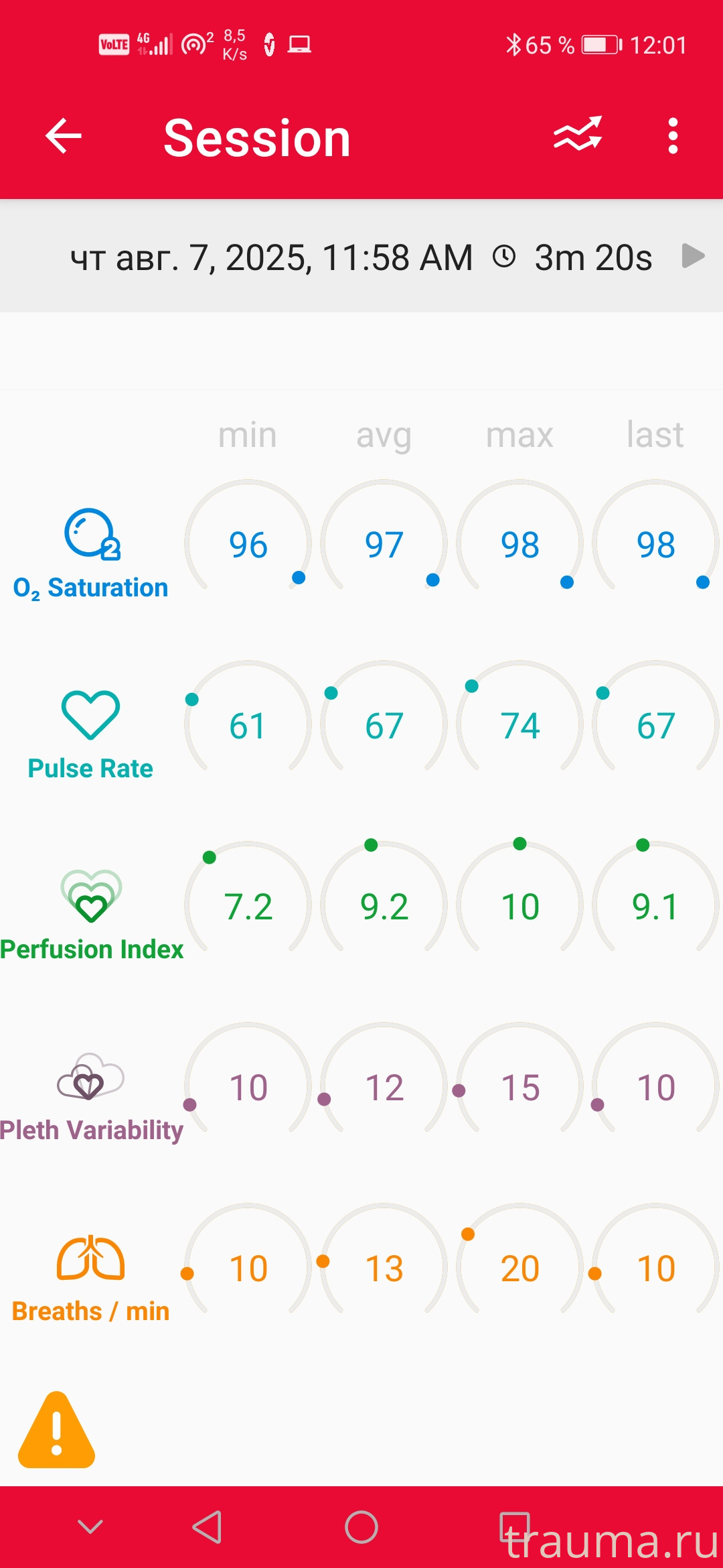 Рентген на дому: по вашему адресу приезжает врач-рентгенолог, травматолог-ортопед с мобильным рентгеновским аппаратом, проводит диагностику травмы или заболевания, делает необходимые рентгенограммы, дает рекомендации по дальнейшему лечению. Получить качественные снимки в домашних условиях возможно благодаря уникальной методике, разработанной МосРентген Центром для института  Склифосовского