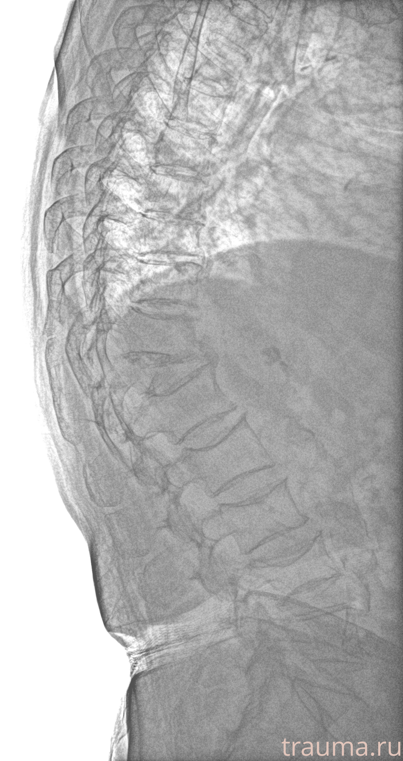 Рентген на дому: по вашему адресу приезжает врач-рентгенолог, травматолог-ортопед с мобильным рентгеновским аппаратом, проводит диагностику травмы или заболевания, делает необходимые рентгенограммы, дает рекомендации по дальнейшему лечению. Получить качественные снимки в домашних условиях возможно благодаря уникальной методике, разработанной МосРентген Центром для института  Склифосовского
